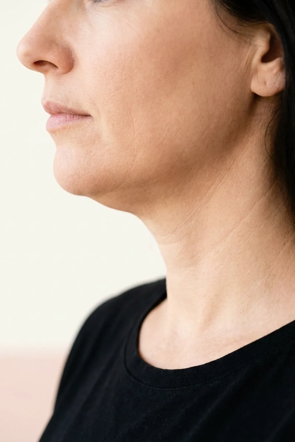 Close view of submental fullness under the chin and jaw, the concern treated at Applegate MedSpa in Covington