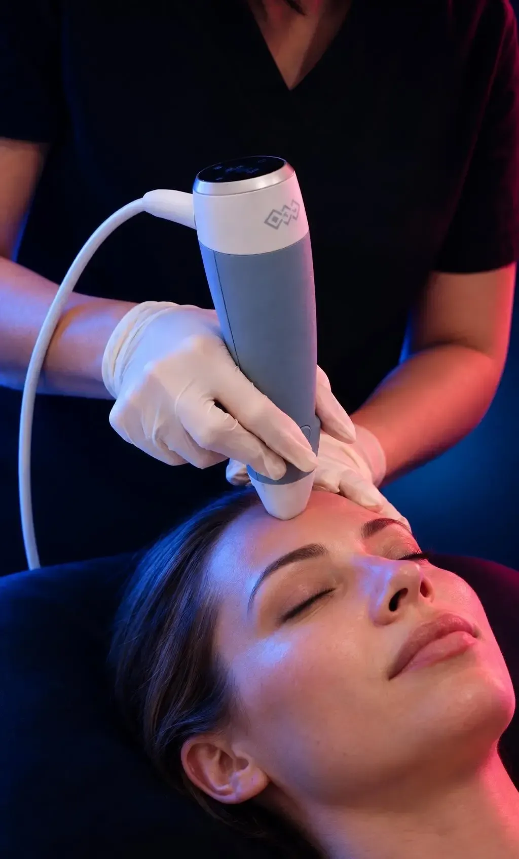 Close view of uneven skin tone with brown spots and sun damage before Exion Clear treatment in Franklin, TN
