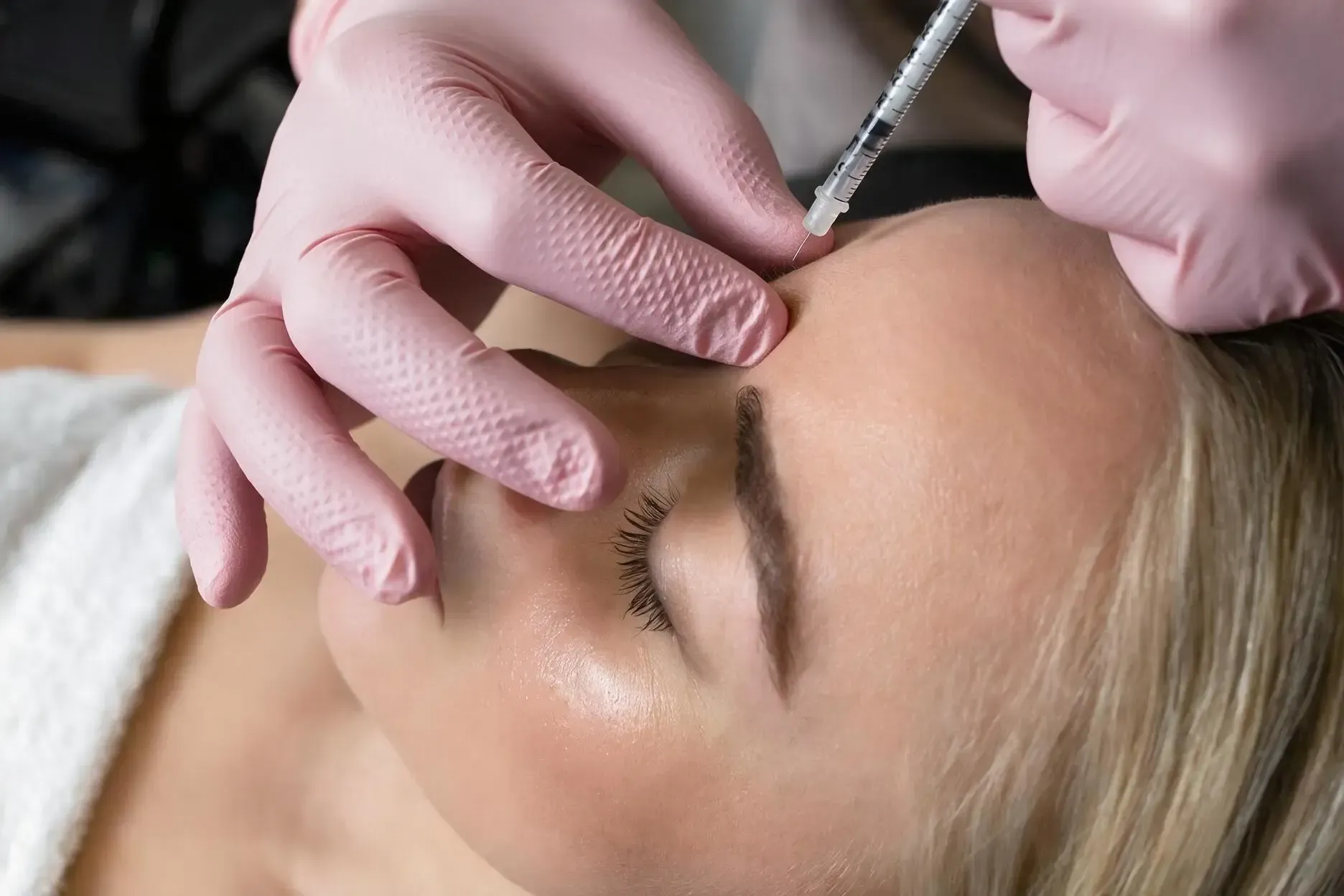 Letybo injection in progress at the glabellar area during treatment at Applegate MedSpa in Covington, KY