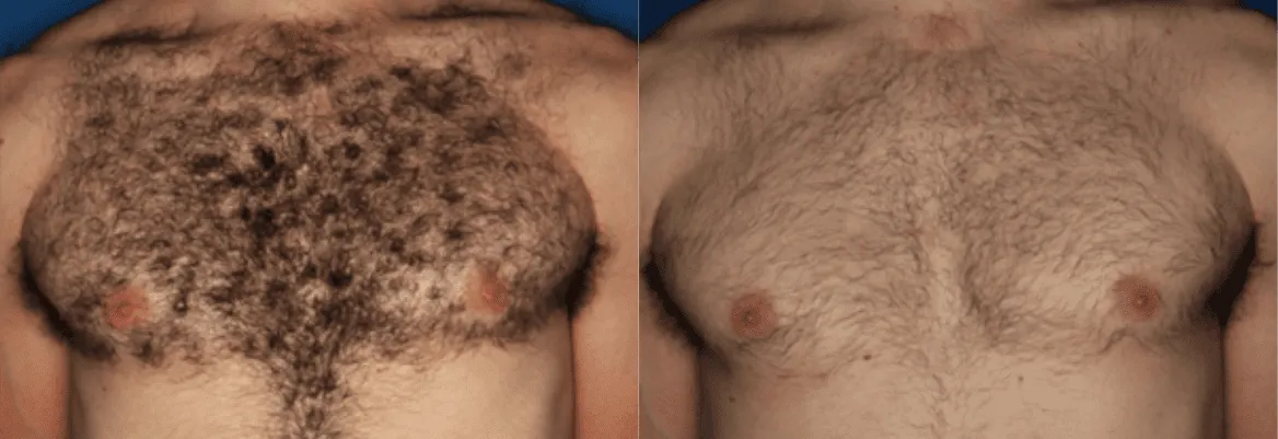 Splendor X before and after