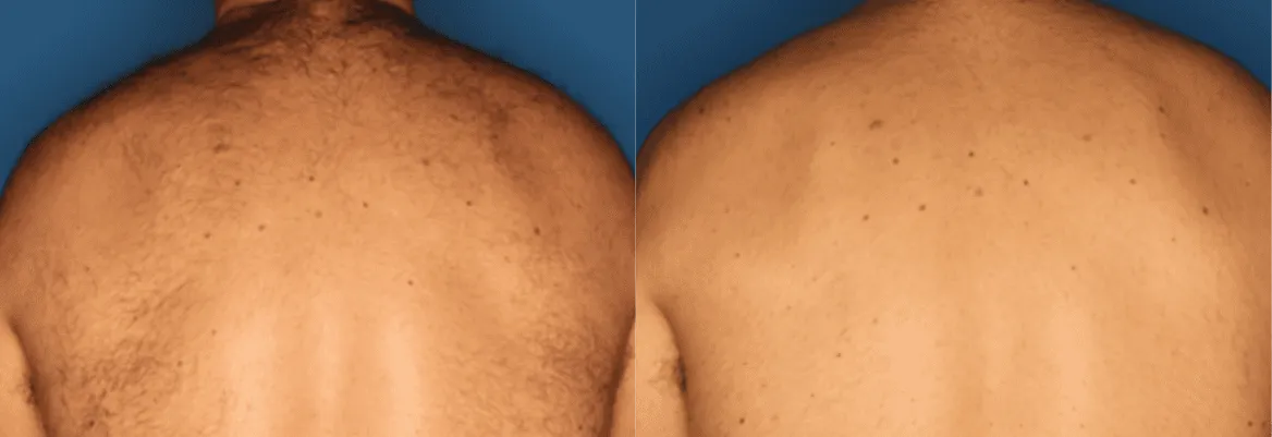 Splendor X before and after
