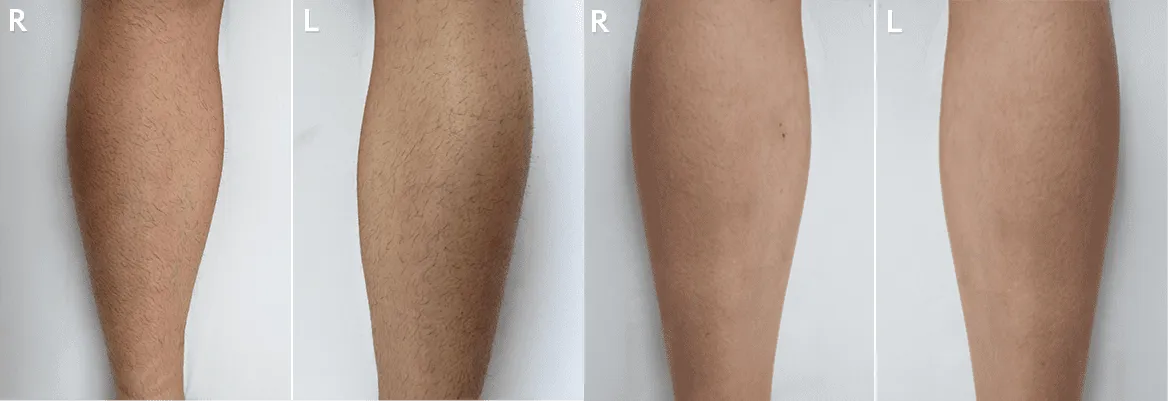 Splendor X before and after