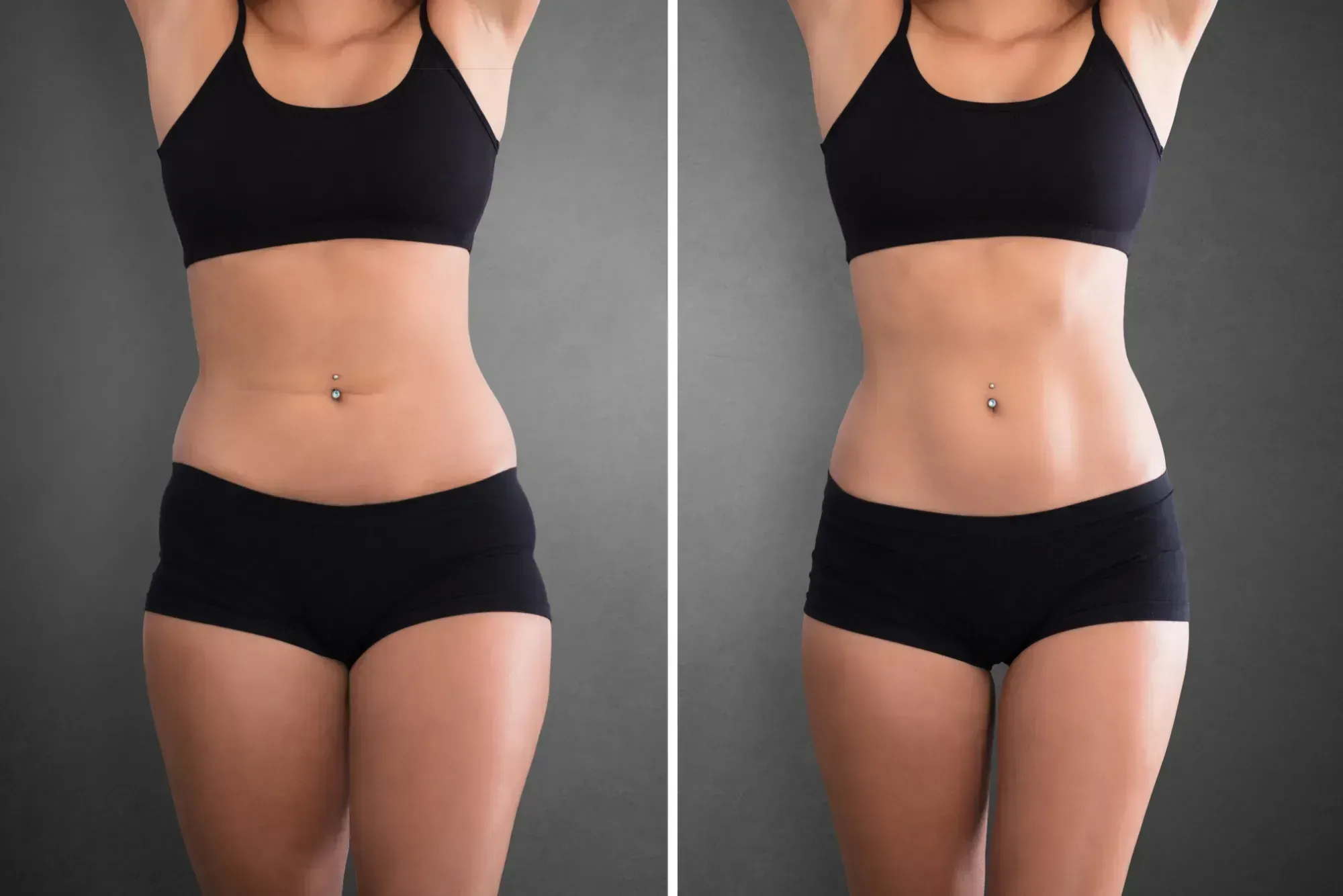 Before and after results from the Aspire Trim Clinic weight loss program in Charlotte, NC, individual results vary