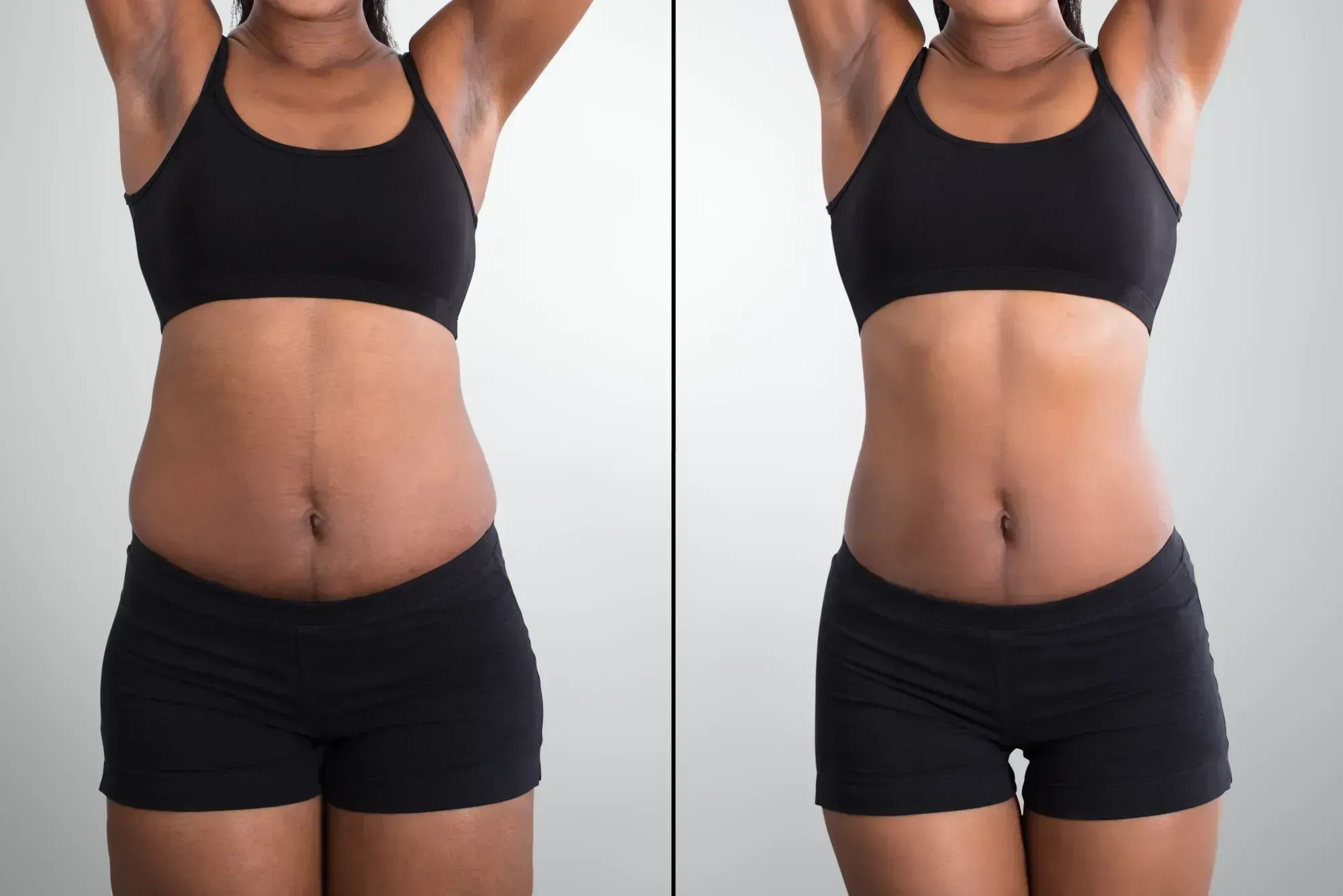 Before and after results from the Aspire Trim Clinic weight loss program in Charlotte, NC, individual results vary