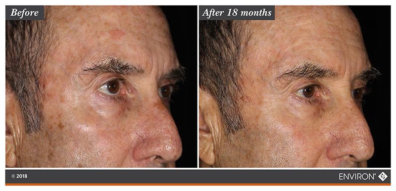 skincare Environ effect on skin