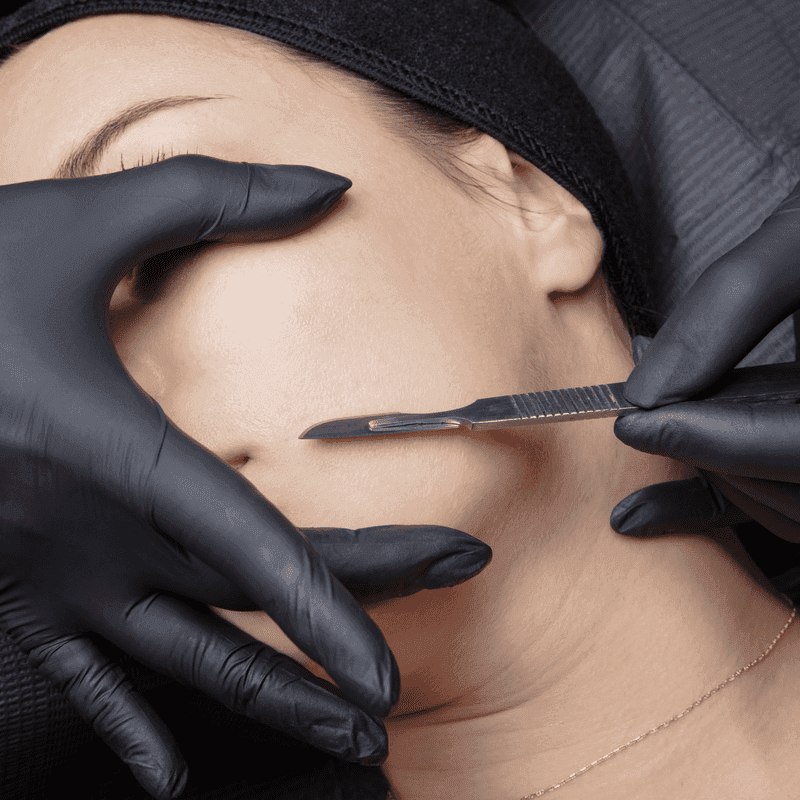 Patient consultation for dermaplaning at Eternal Wellness Medical Spa Traverse City