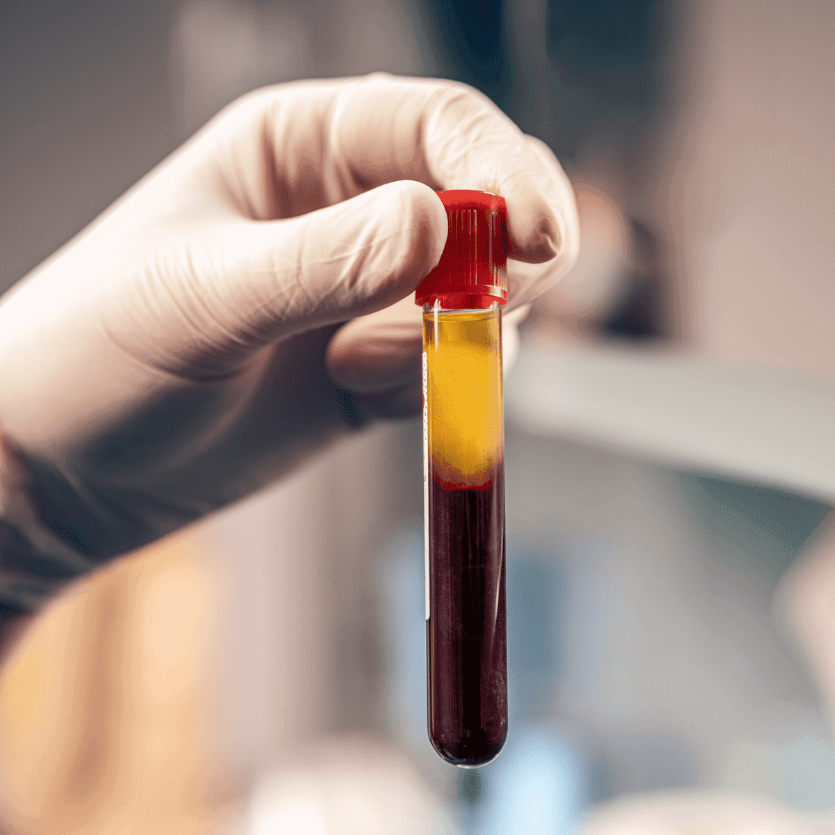 Confident patient portrait after PRP and PRF at Eternal Wellness Traverse City