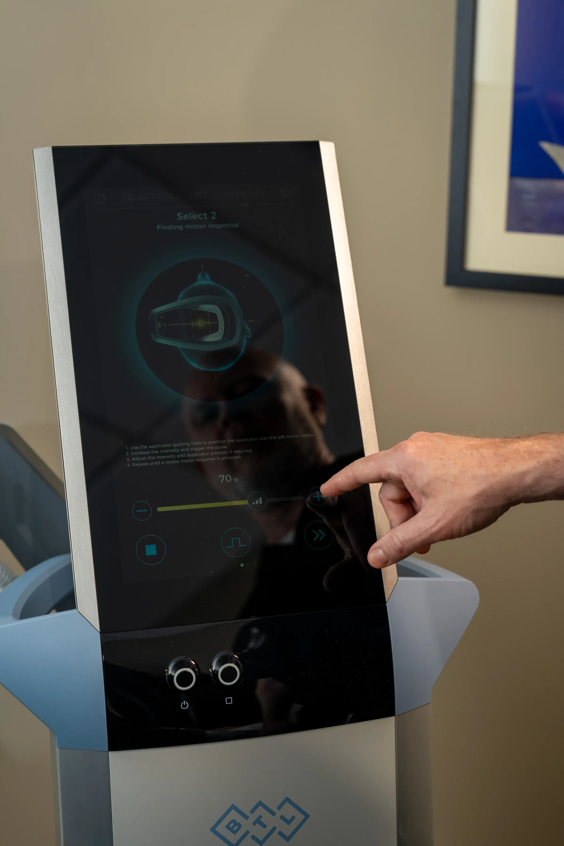 Before and after mood improvement with TMS therapy