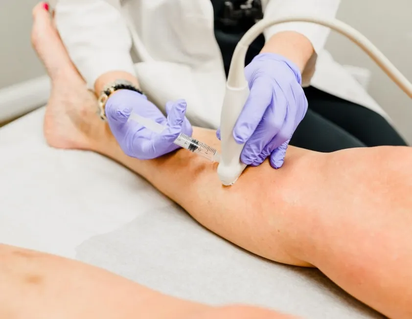 Before and after illustration of radiofrequency ablation treatment results for chronic pain