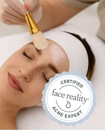 Confident patient portrait after Acne Bootcamp at Eternal Wellness Traverse City