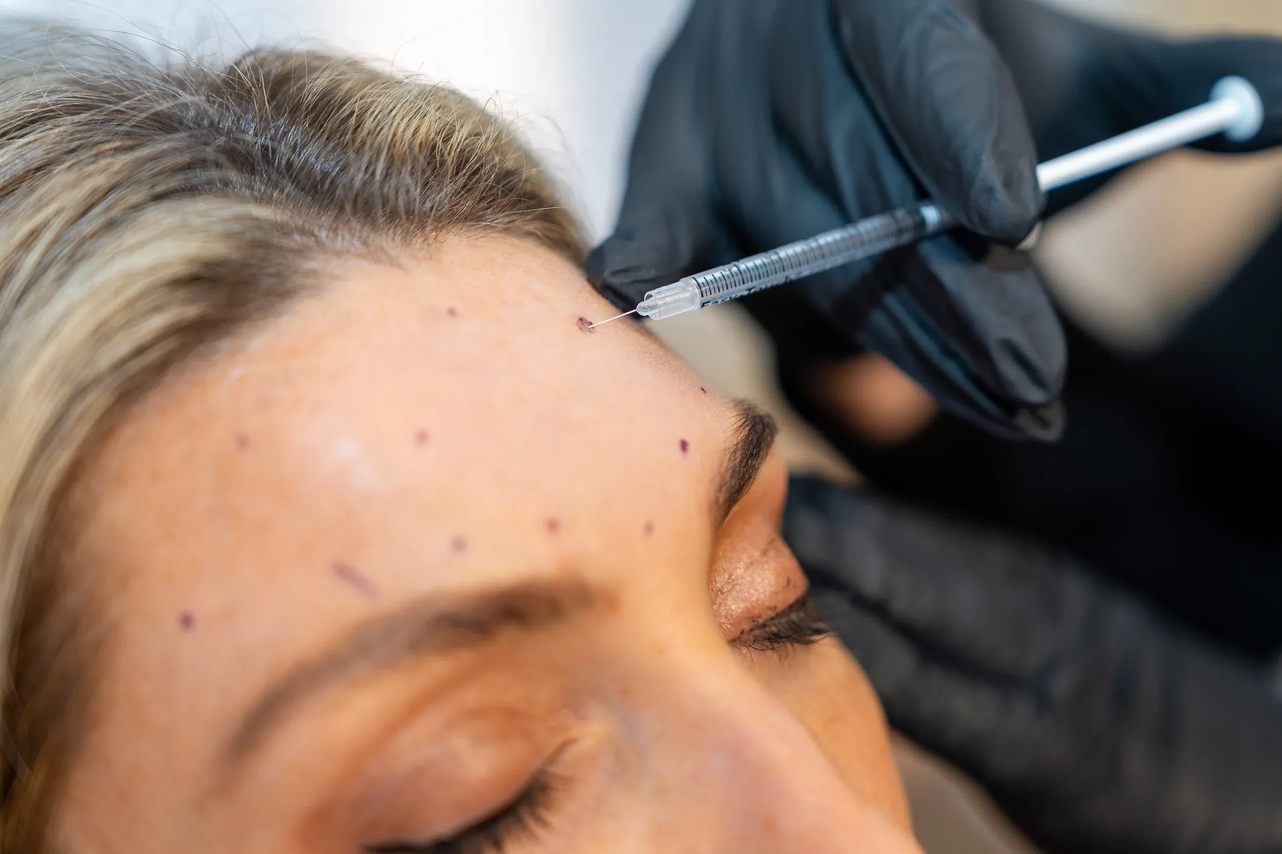 Daxxify vial and injection supplies at Eternal Wellness Medical Spa Traverse City