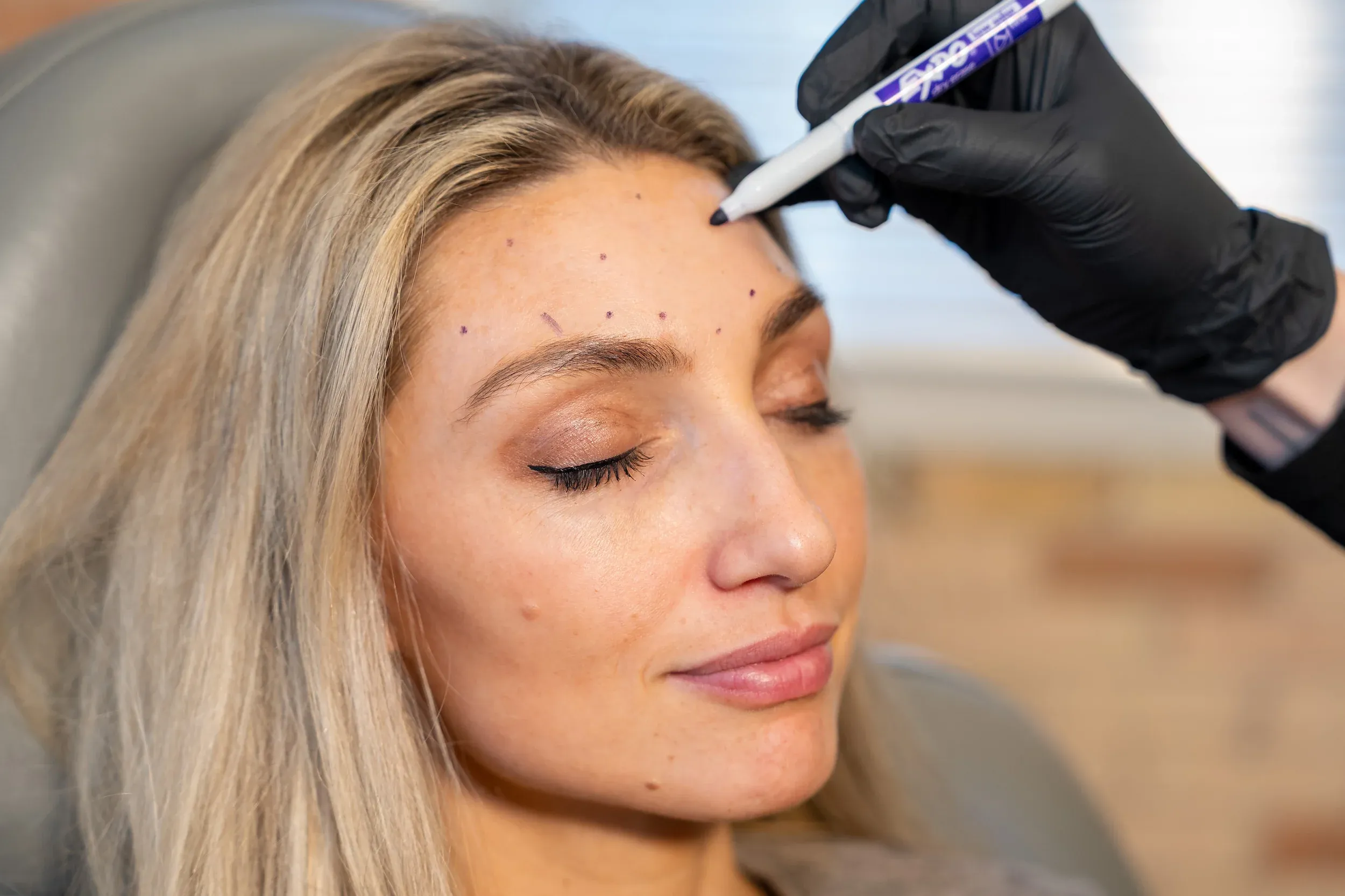 Before and after Daxxify results showing wrinkle reduction at Eternal Wellness Traverse City