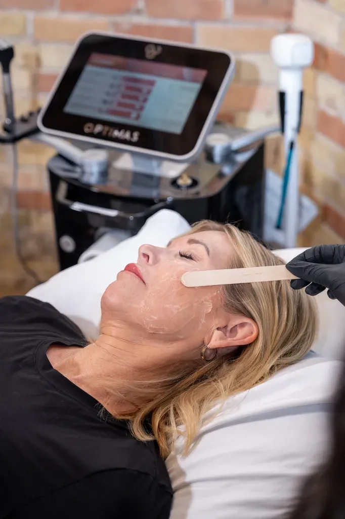 Patient consultation for Forma RF skin remodeling at Eternal Wellness Medical Spa Traverse City