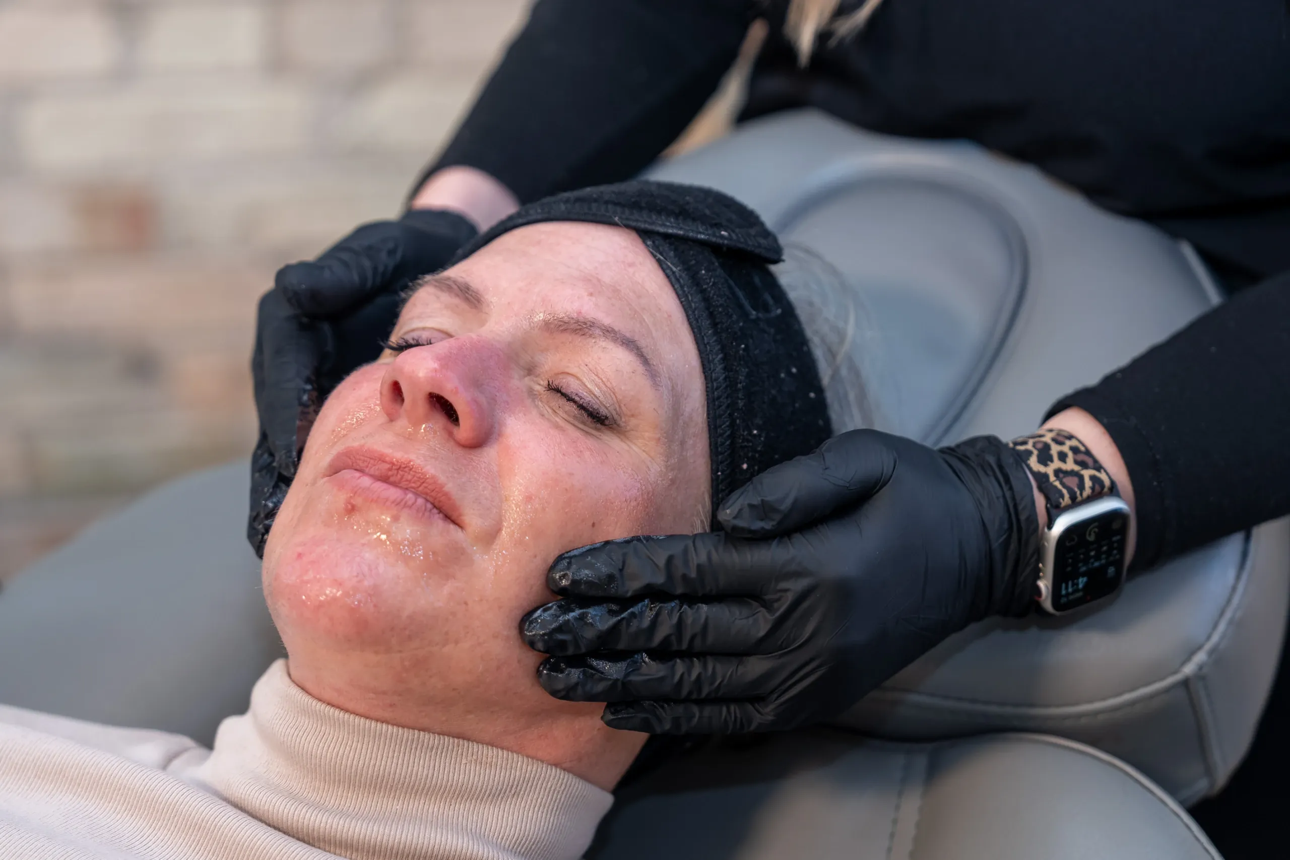 Woman with smooth rejuvenated skin after CoolPeel CO2 laser treatment at Eternal Wellness Medical Spa in Traverse City MI