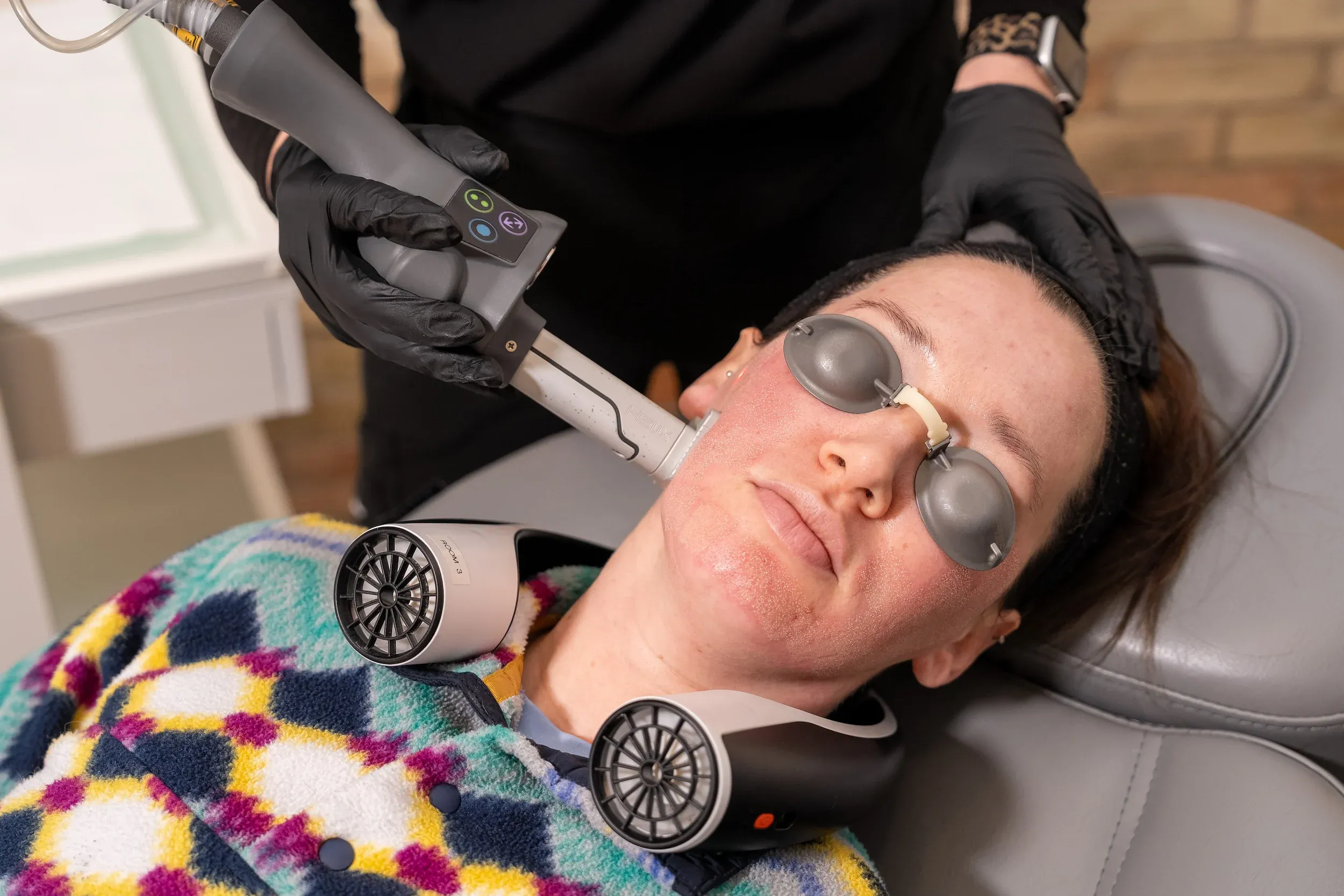 Helix CO2 laser skin resurfacing treatment at Eternal Wellness Medical Spa in Traverse City Michigan