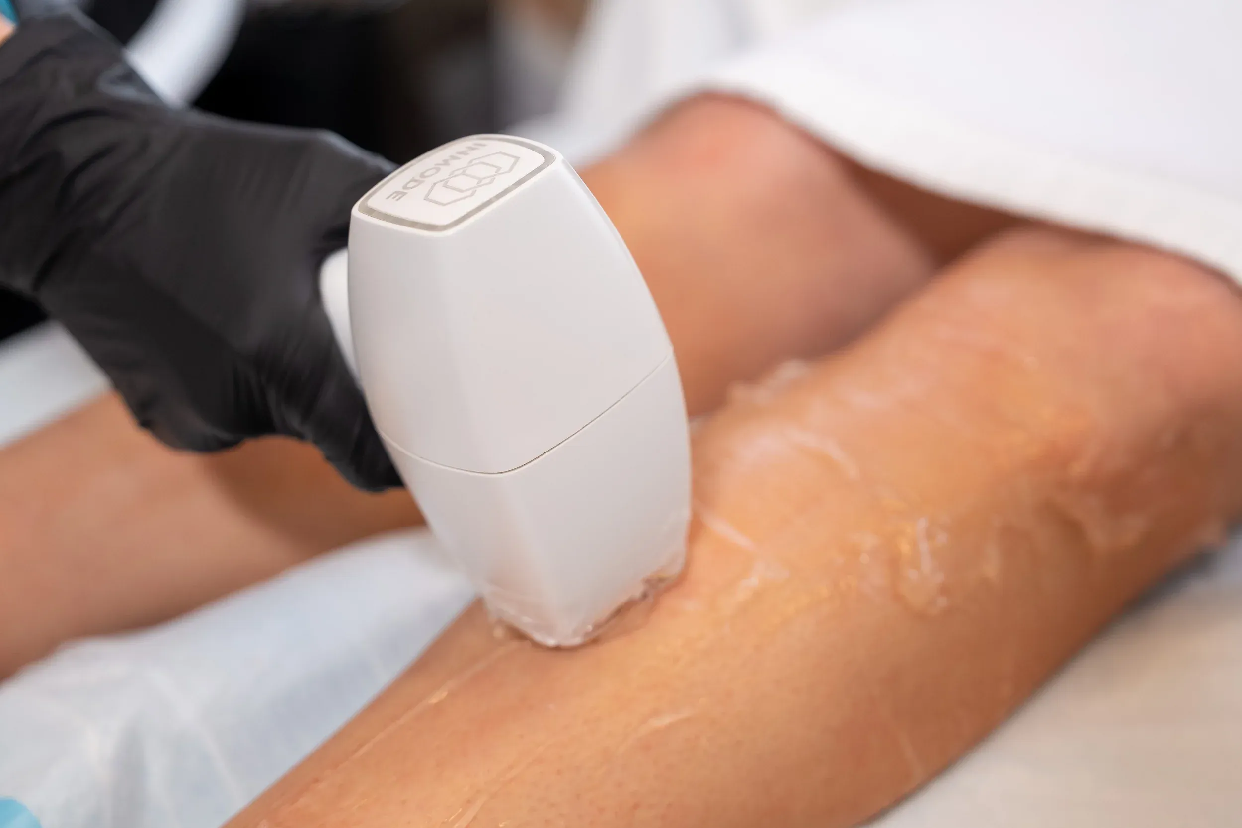 Safety and clinical information for DiolazeXL laser hair removal at Eternal Wellness Traverse City
