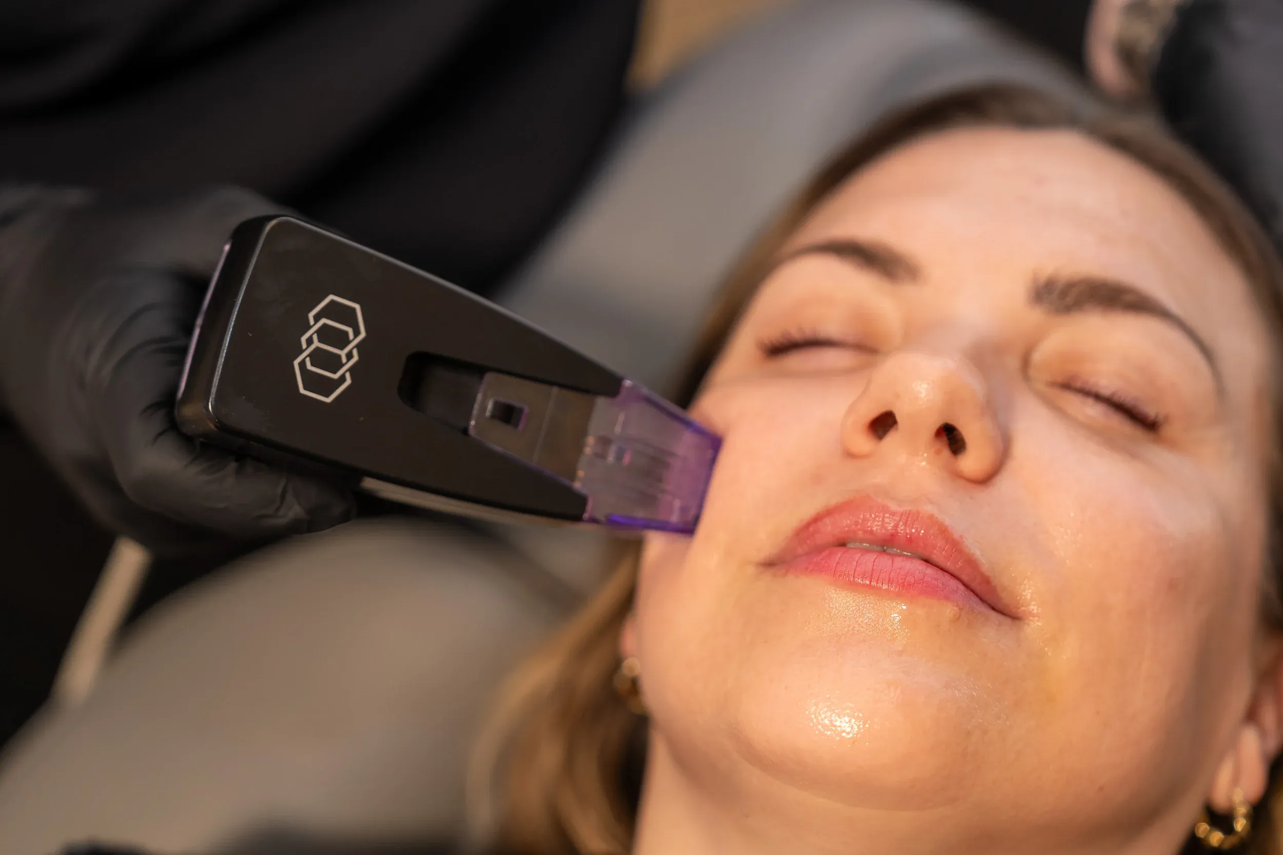 Confident patient portrait after Morpheus8 RF microneedling at Eternal Wellness Traverse City