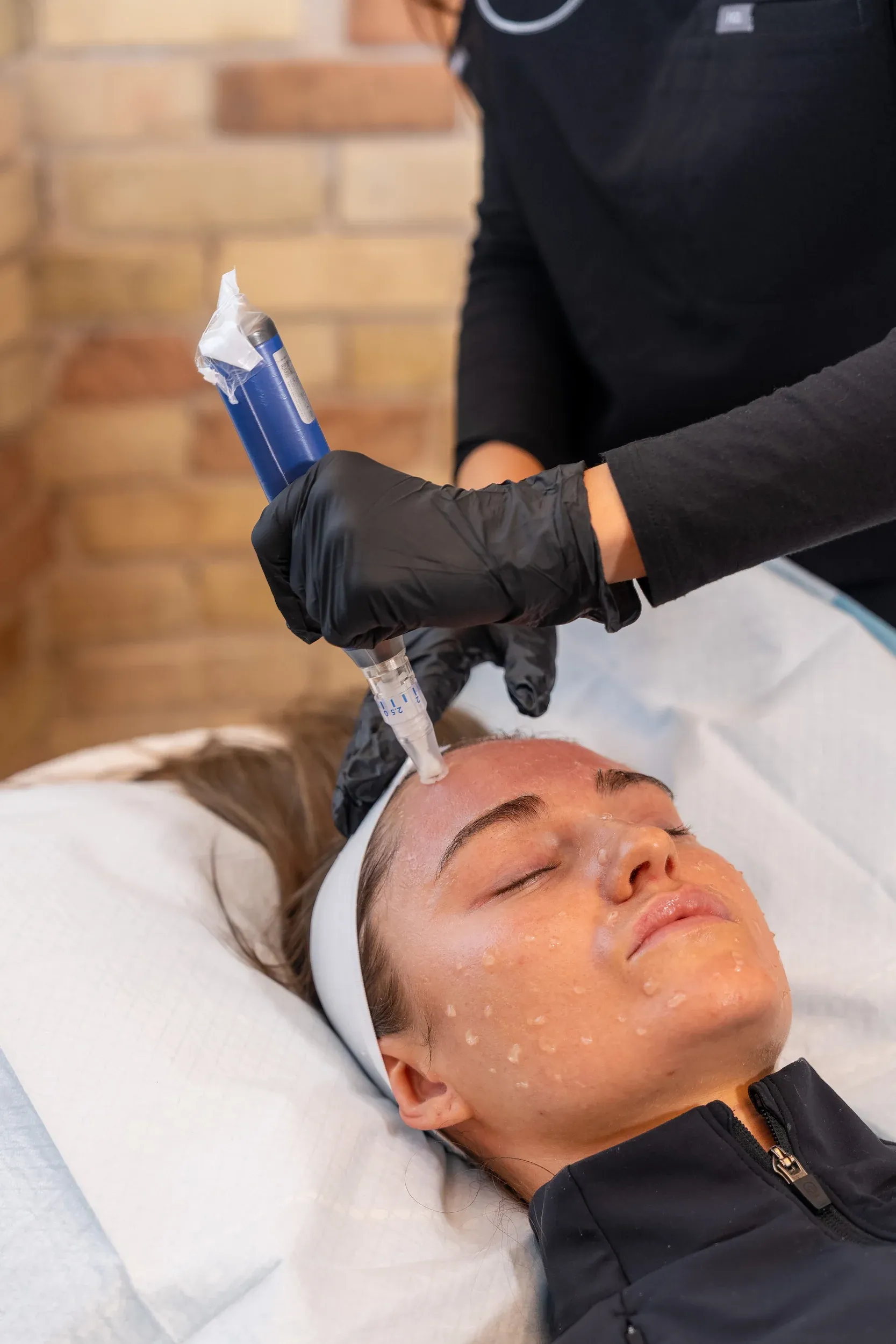 SkinPen microneedling device used at Eternal Wellness Medical Spa Traverse City