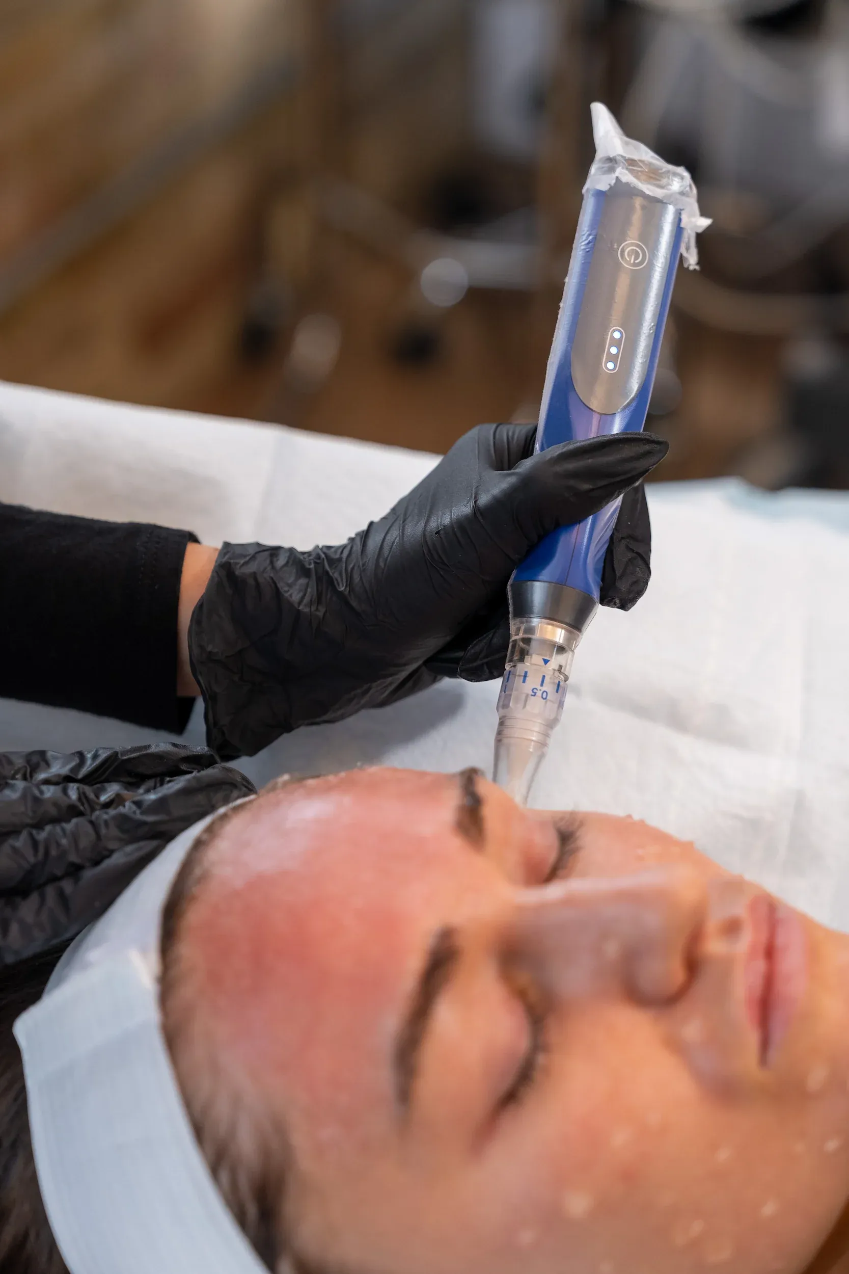 Before and after SkinPen microneedling results showing skin texture improvement at Eternal Wellness Traverse City