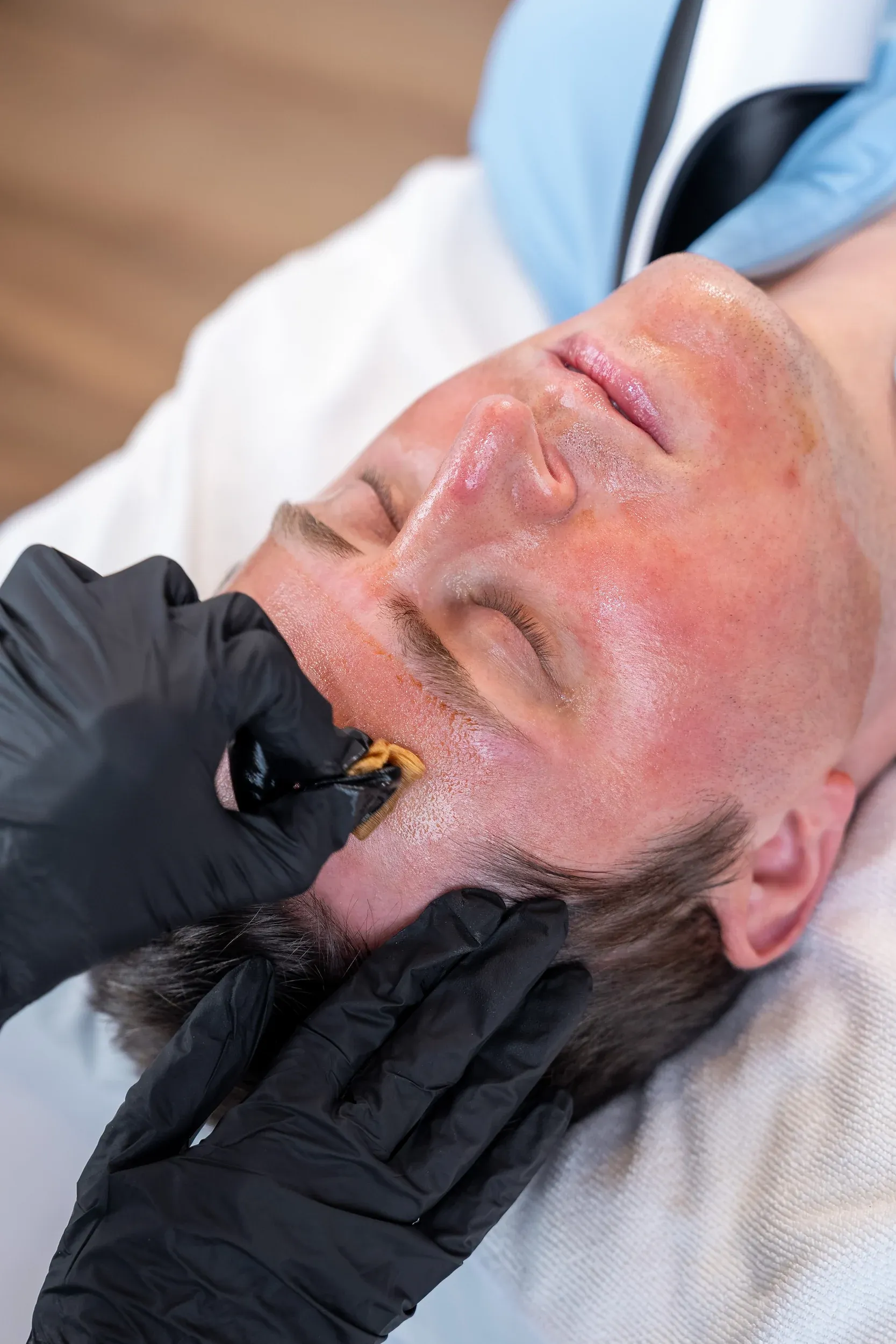 Patient consultation for VI Chemical Peel at Eternal Wellness Medical Spa Traverse City