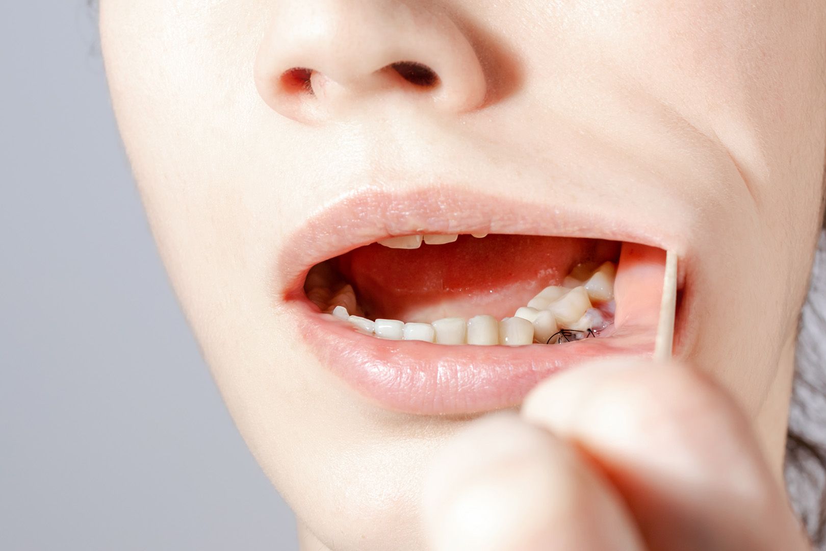 Patient receiving a gentle gum grafting consultation at Cook Family Dentistry