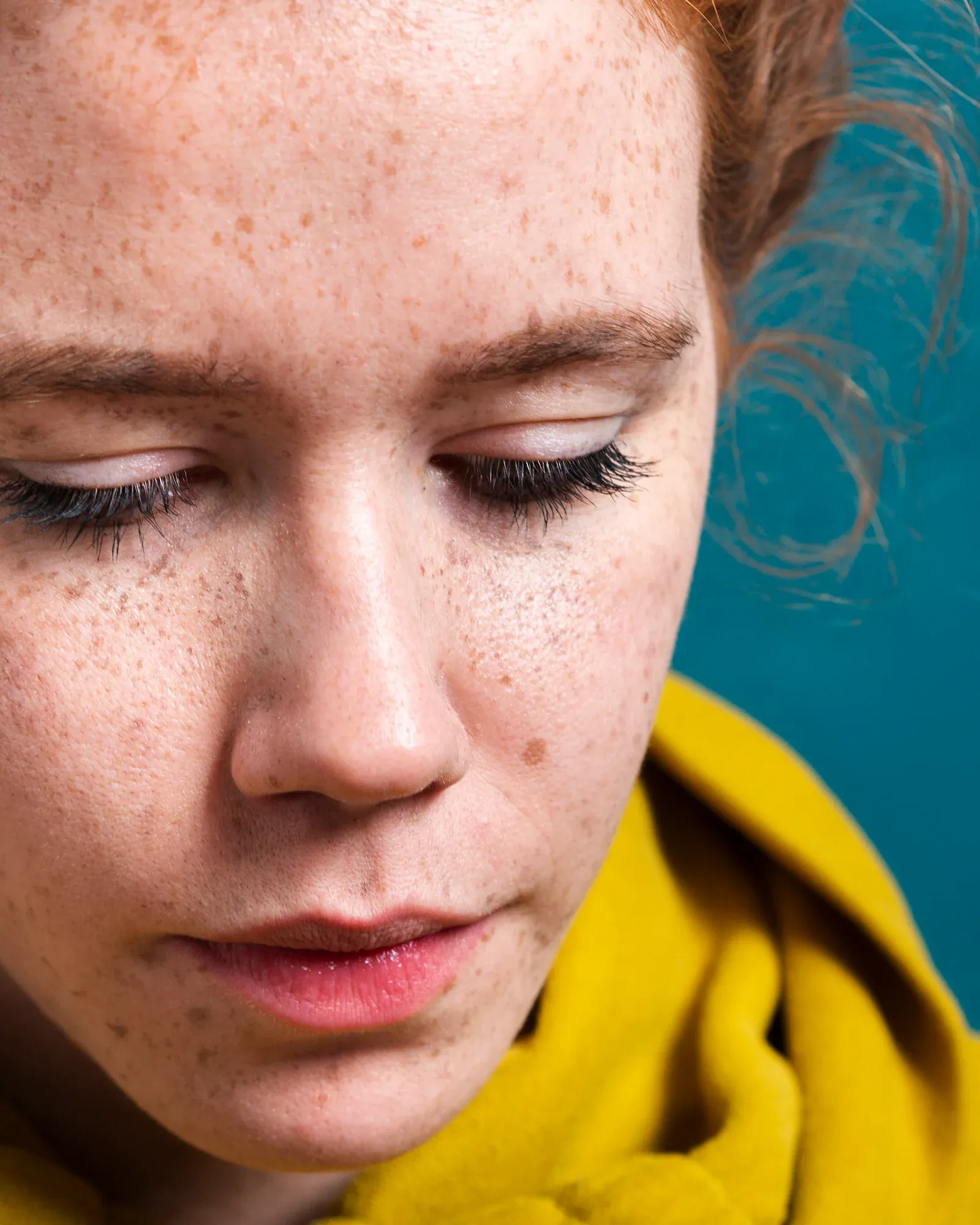 Close-up of photoaged skin showing pigmentation and texture at Resurgent Health Fargo