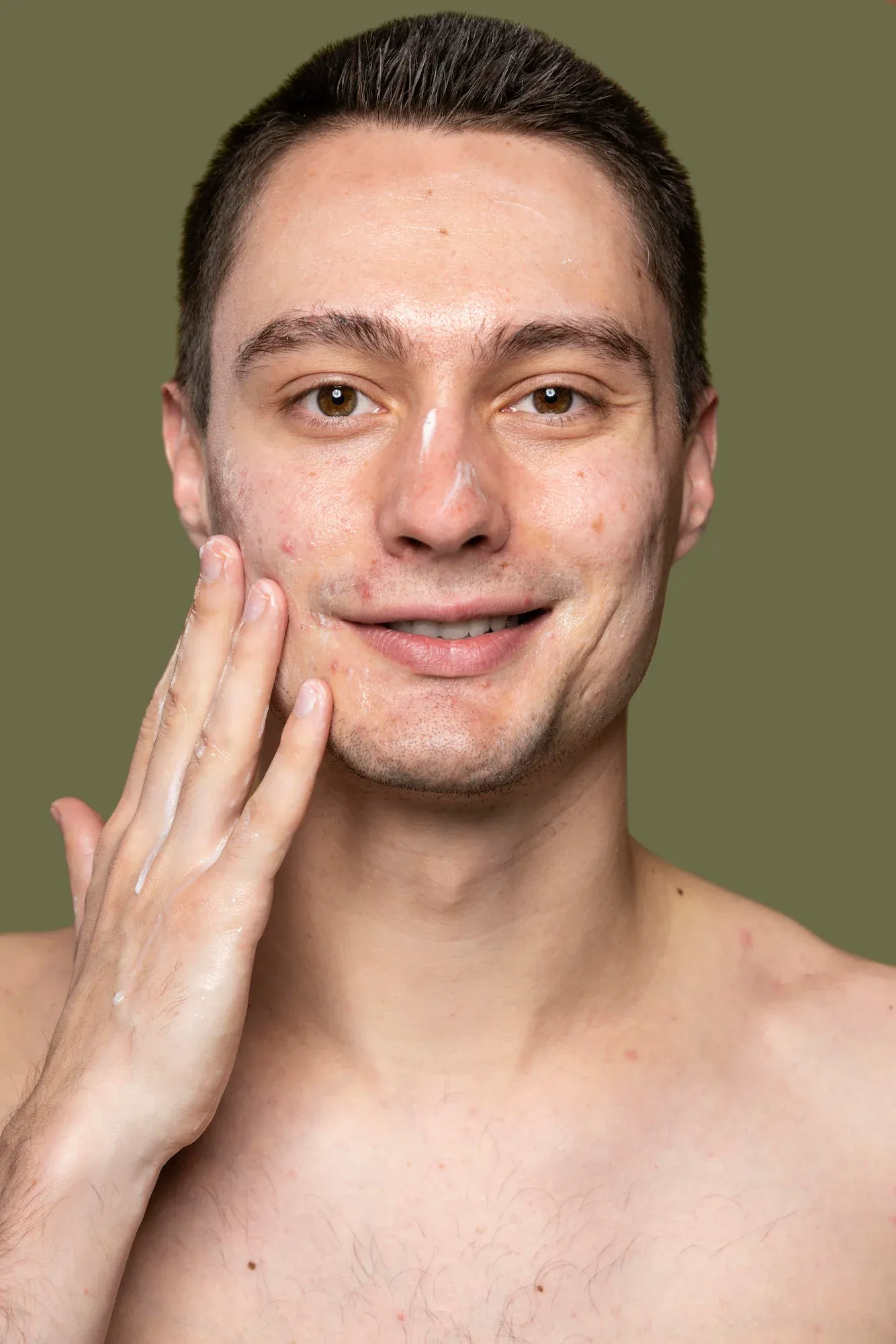 Illustration of clogged follicle and sebaceous gland at Radiant Laser MD Cambridge