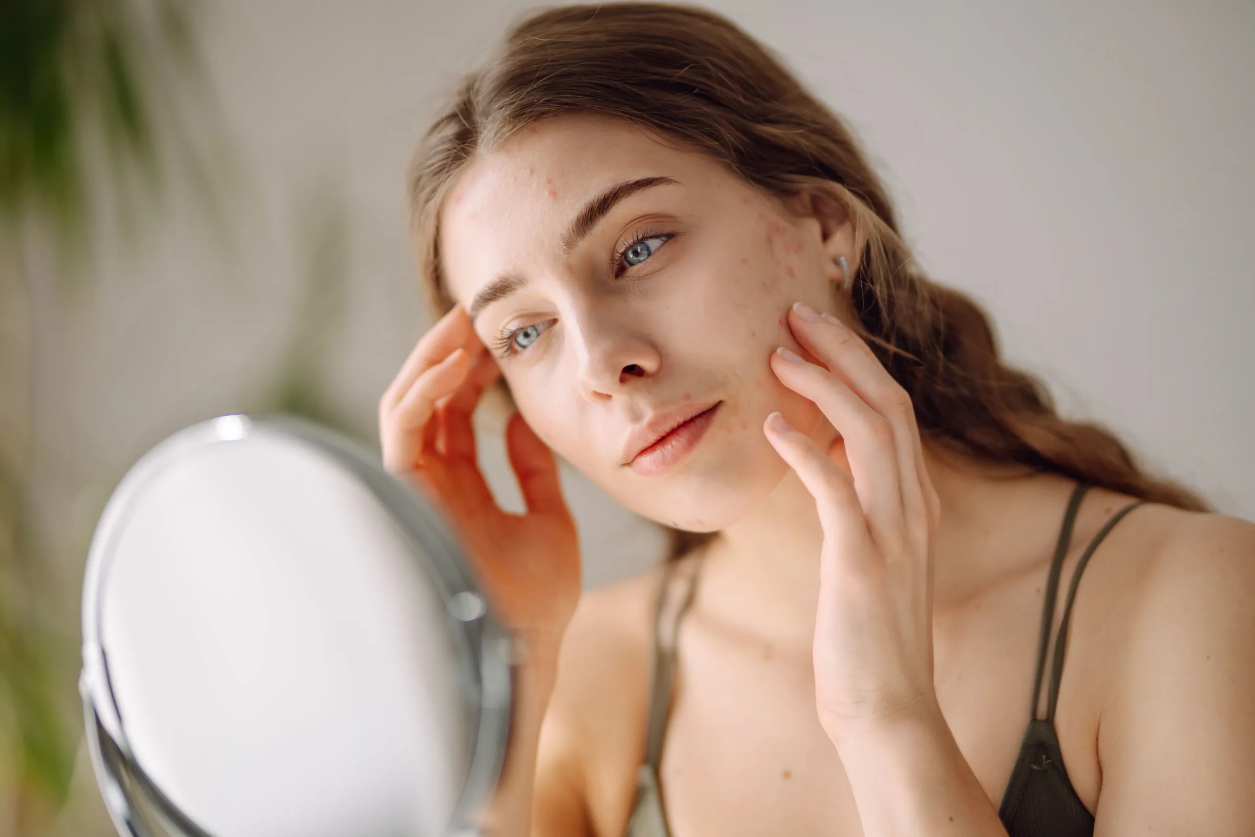 Person concerned about acne scarring at Eternal Wellness Medical Spa Traverse City