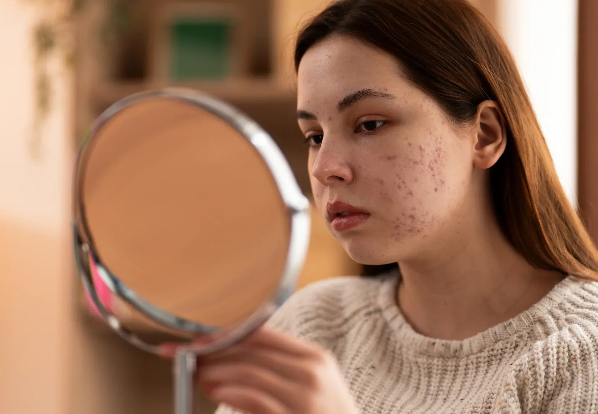 Person examining acne scars in mirror at Resurgent Health Fargo