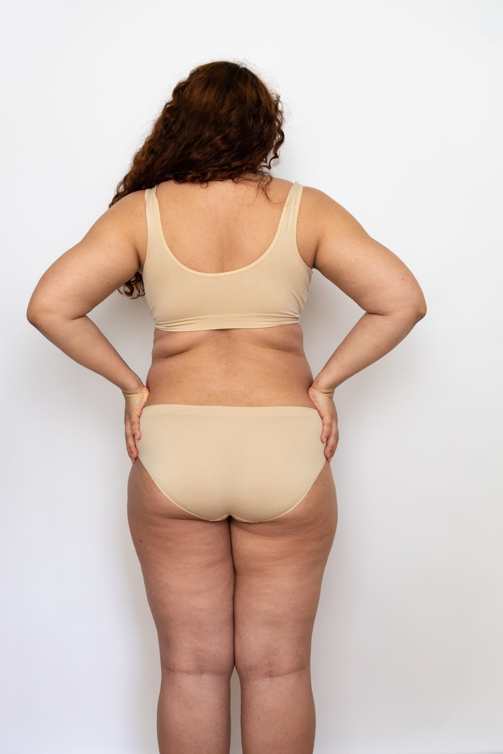 Illustration of fibrous septa and fat chambers causing cellulite at ProActive Chiropractic and Wellness Center Tampa