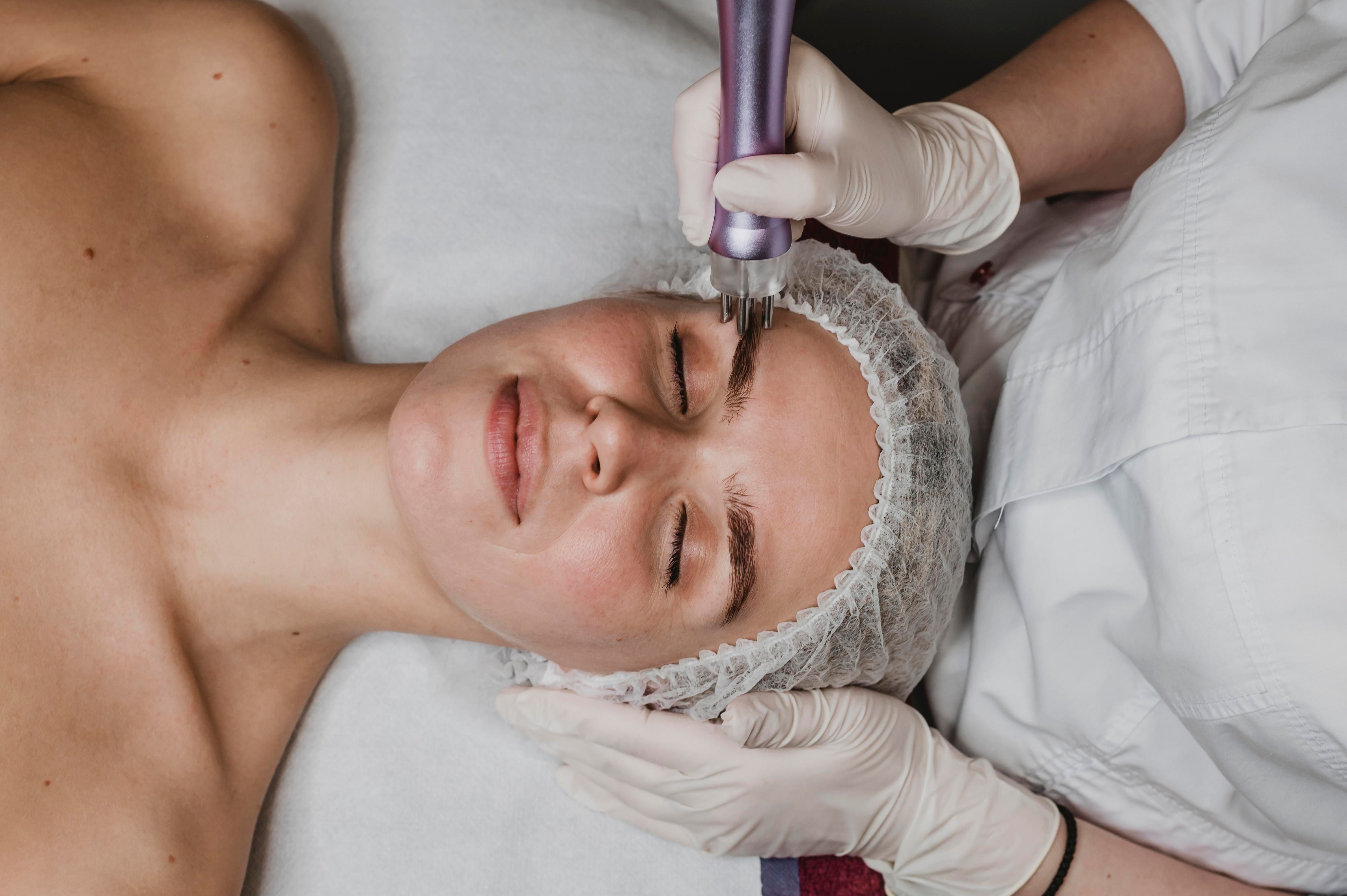 RF Microneedling vs Traditional Microneedling: Which Works Better?