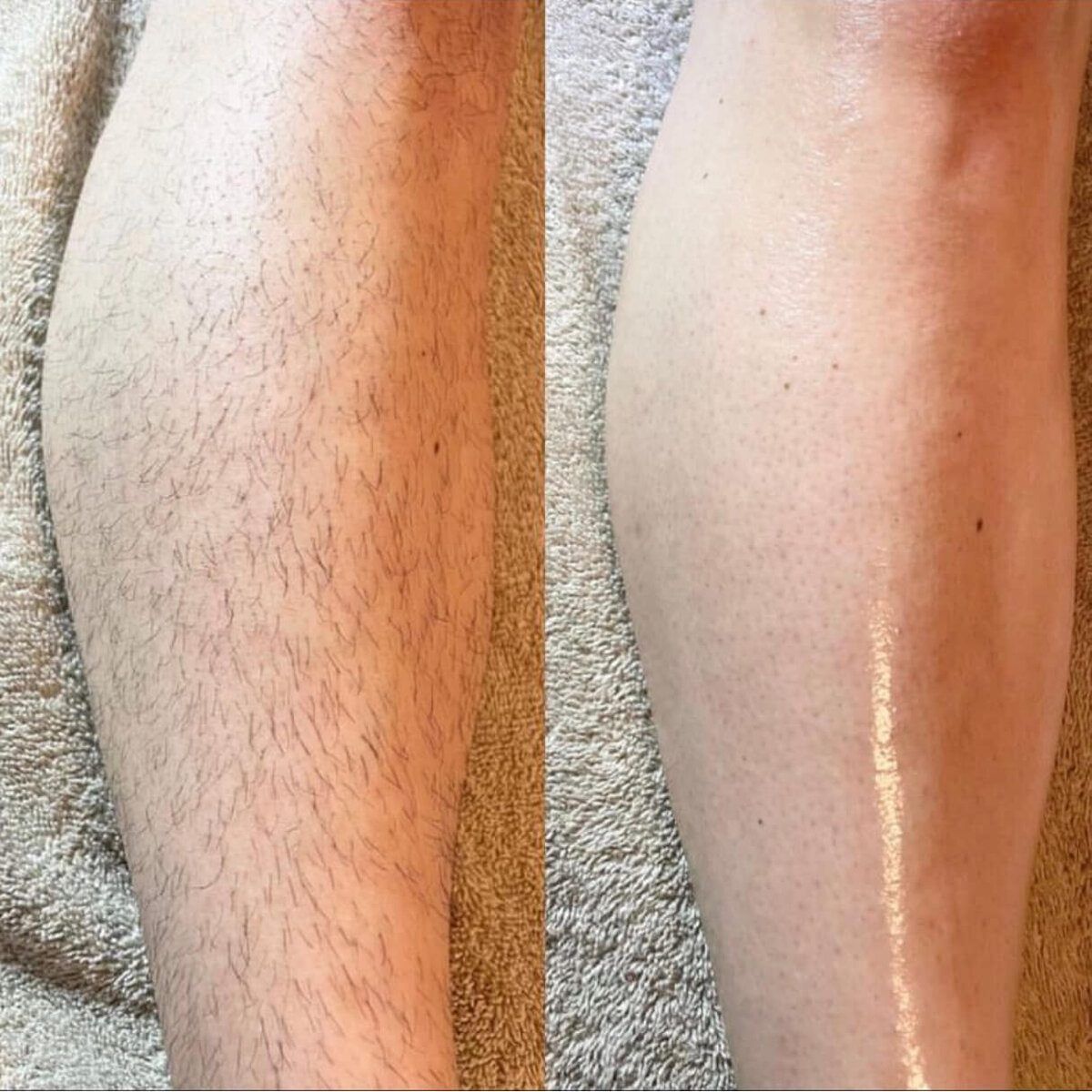 Spa Waxing before and after