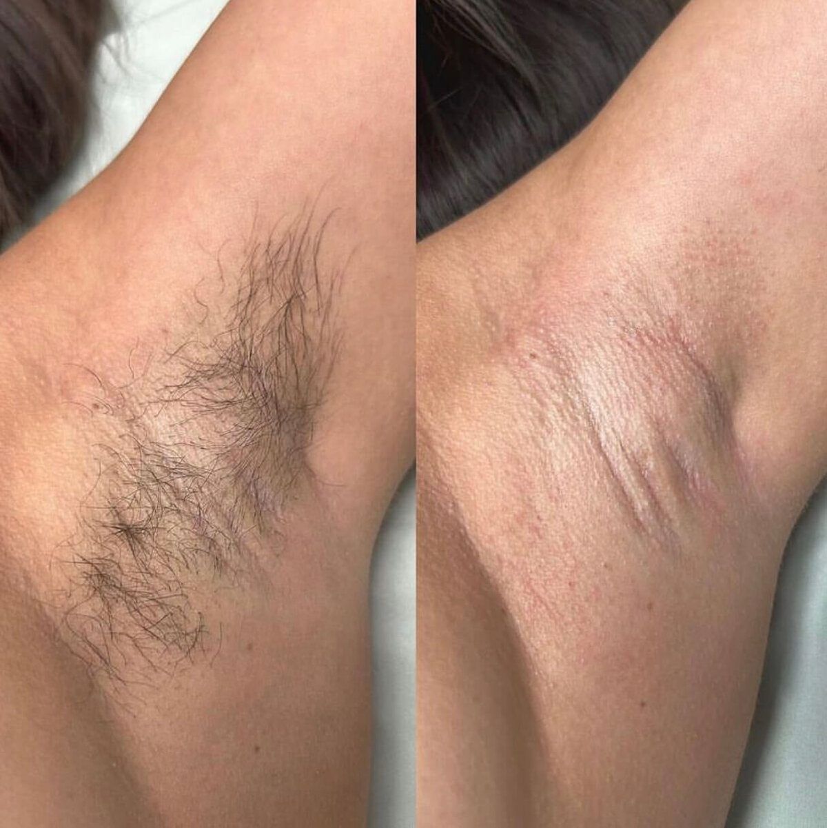 Spa Waxing before and after