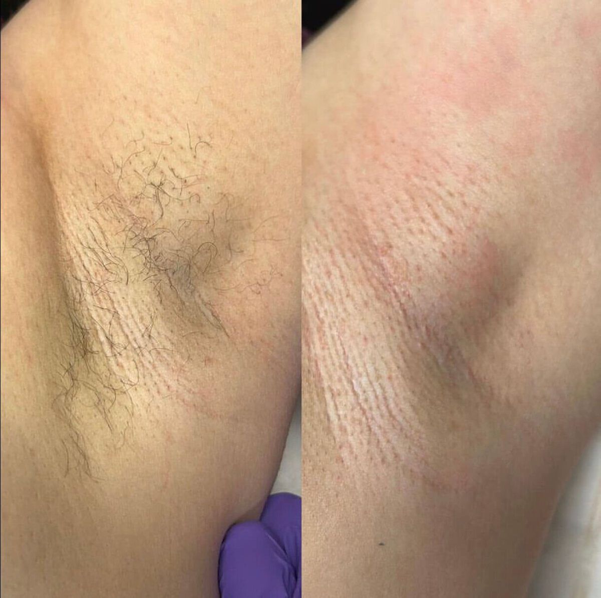 Spa Waxing before and after