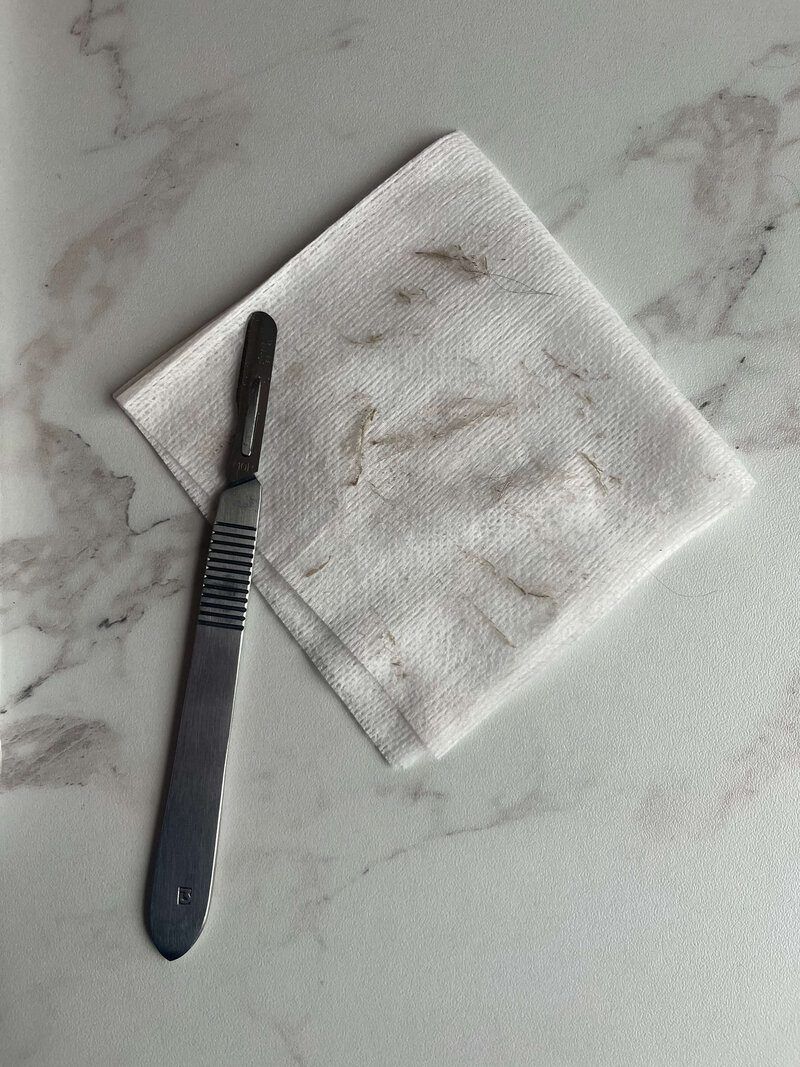 Before and after dermaplaning results showing smoother skin at Eternal Wellness Traverse City