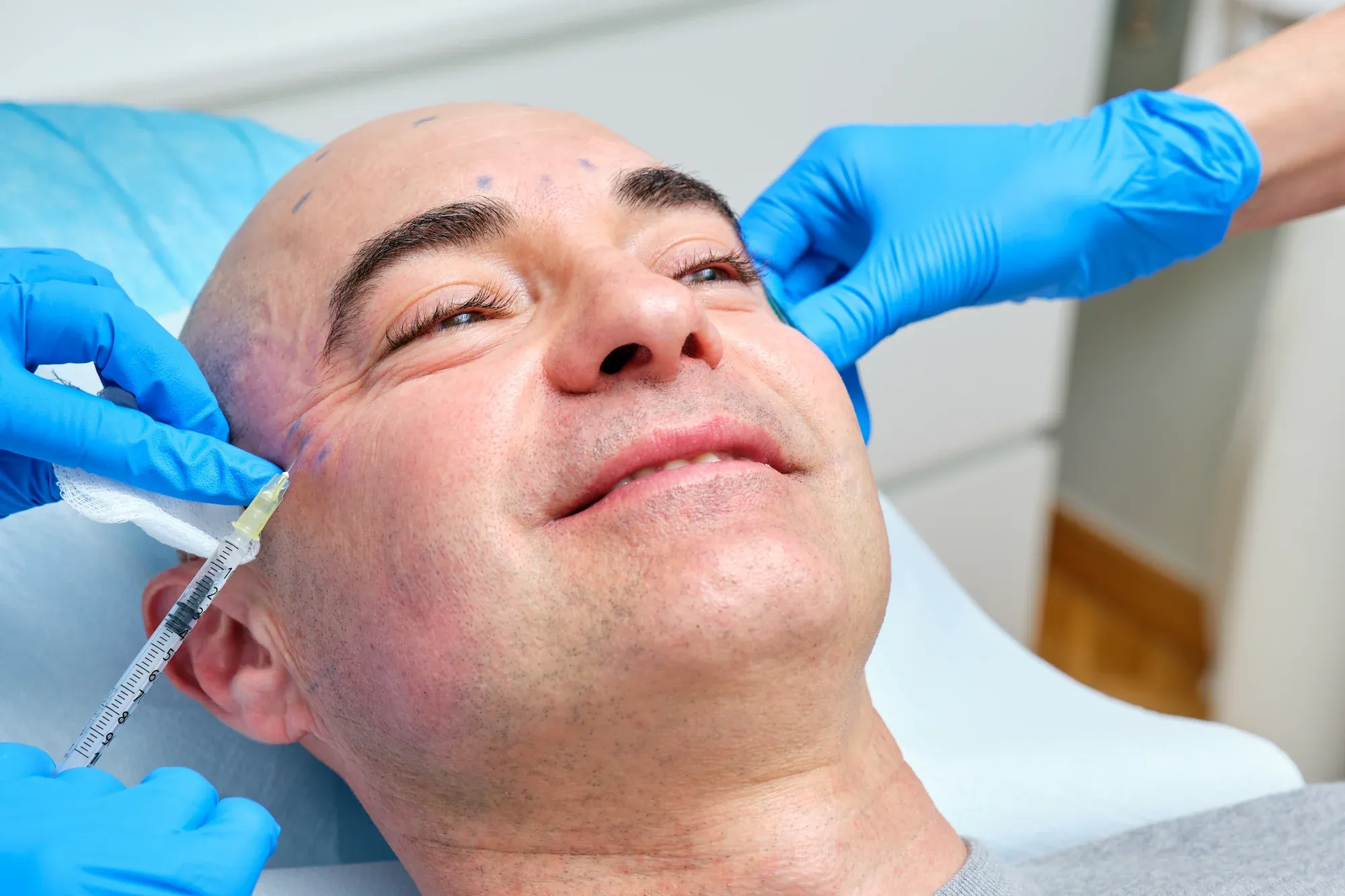 Botox cosmetic injections at Cook Family Dentistry in Santa Rosa Beach, FL