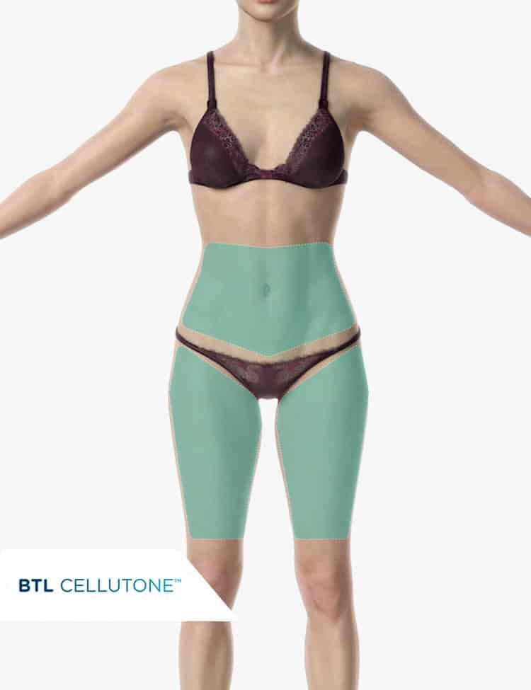 BTL Cellutone device used at Arise Integrative Wellness Port Charlotte