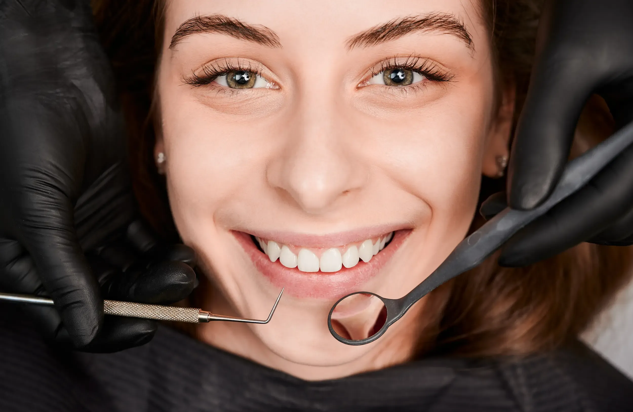 What to Expect During a Professional Teeth Whitening Session at the Dentist