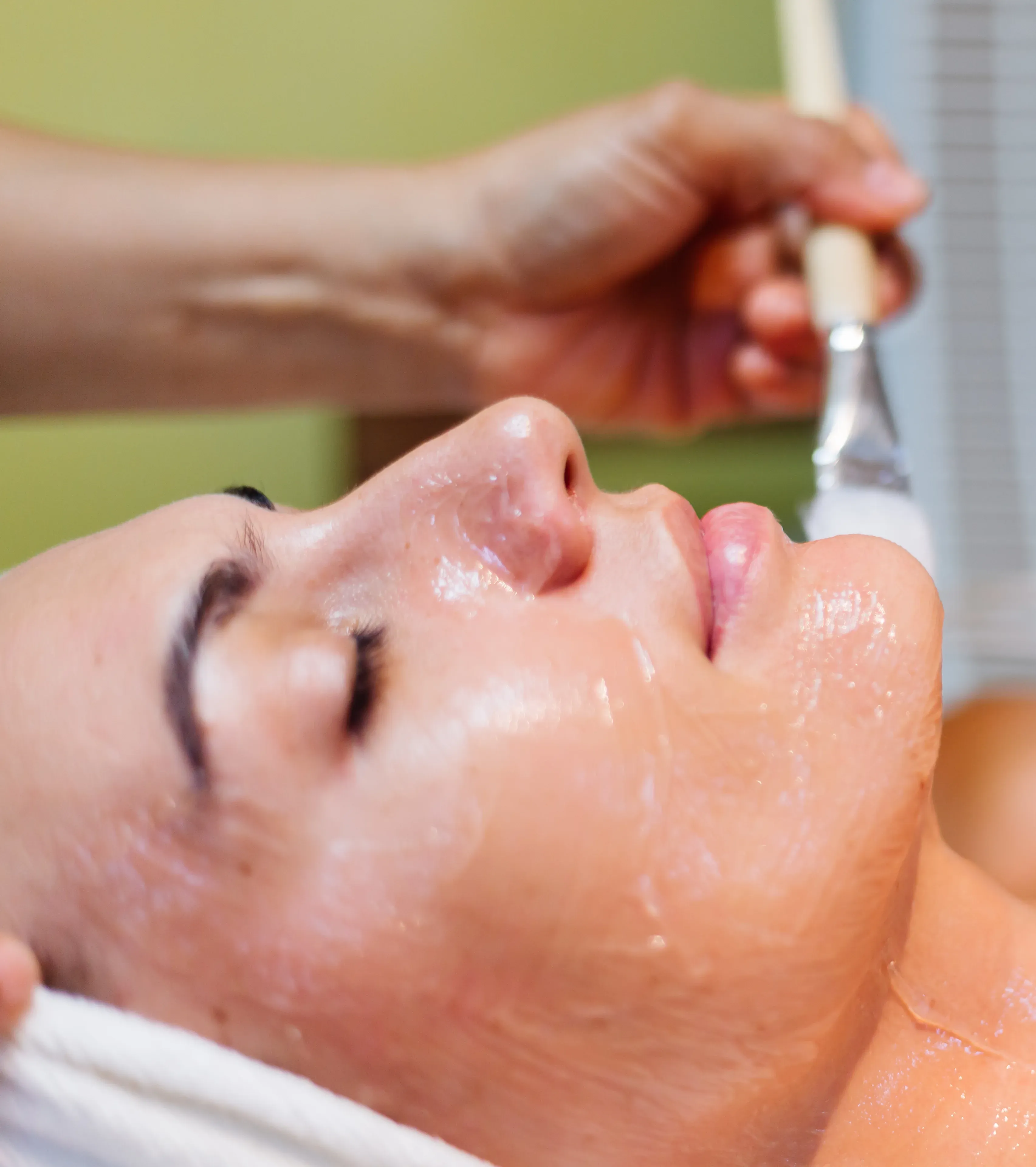 Before and after chemical peel results showing improved skin clarity