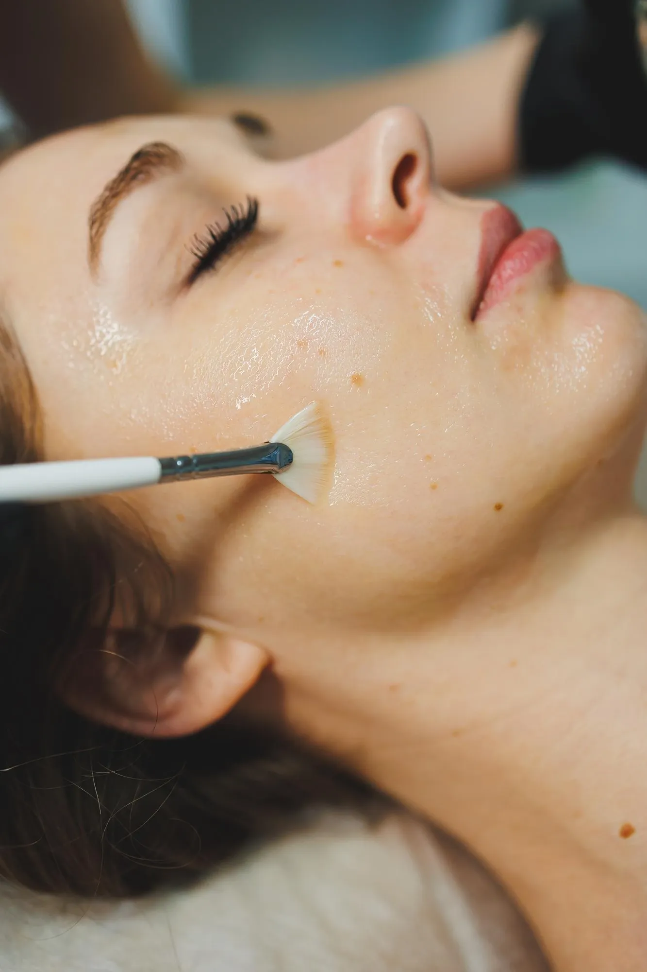 Chemical peel safety and aftercare information