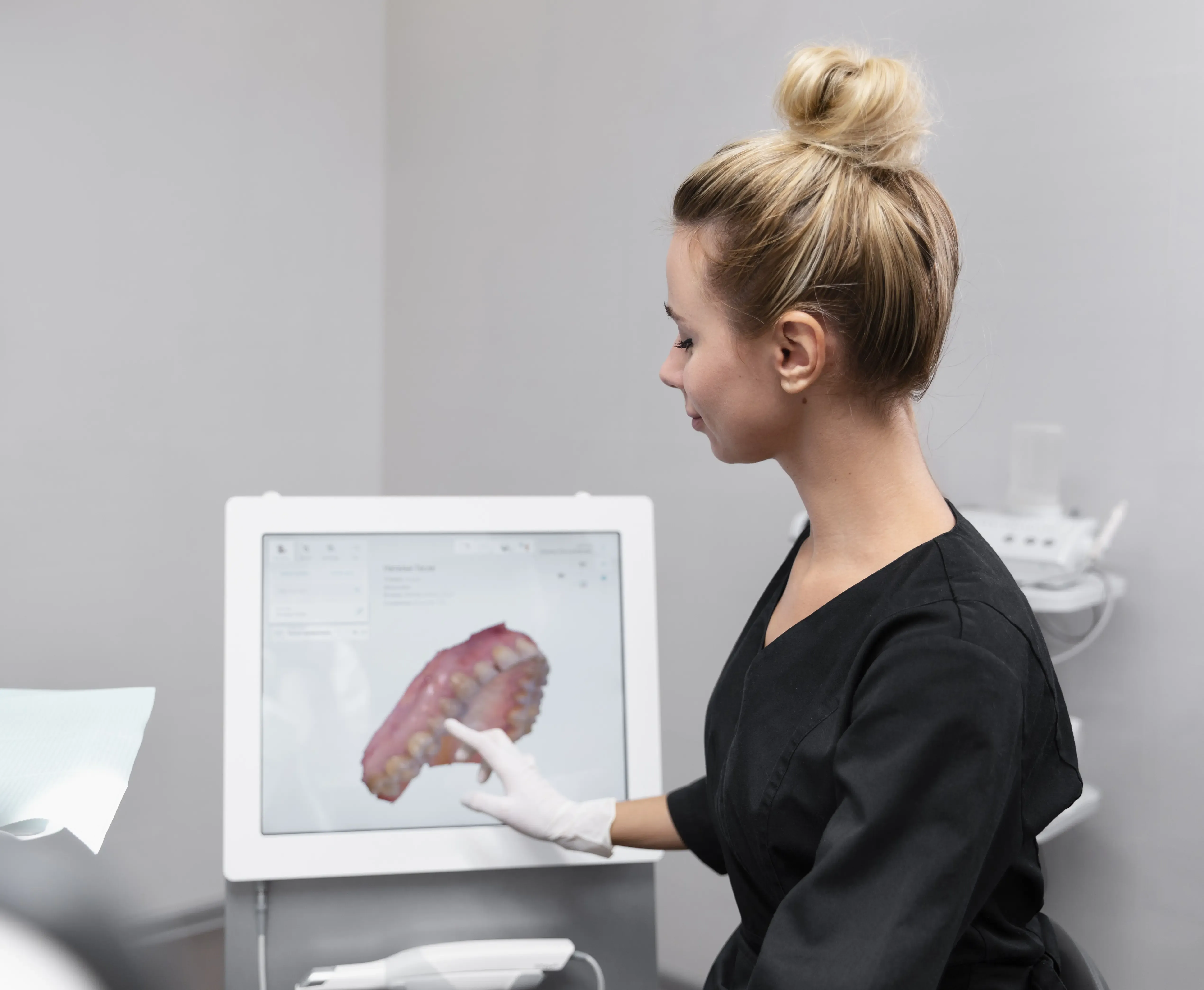 Before and after 3D digital dental scanning results at East Ellijay Family & Cosmetic Dentistry East Ellijay