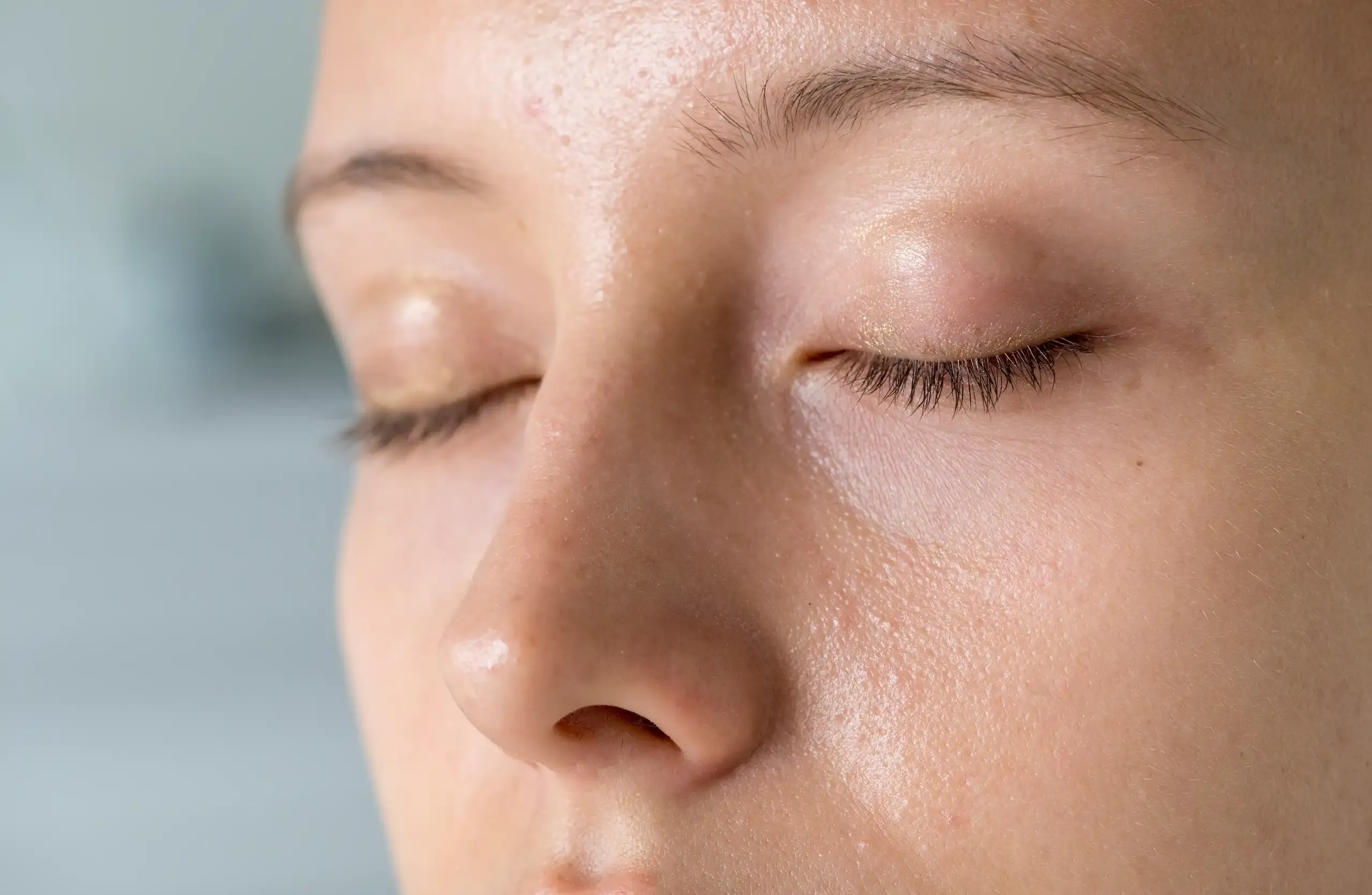 Dilated Pores Treatment