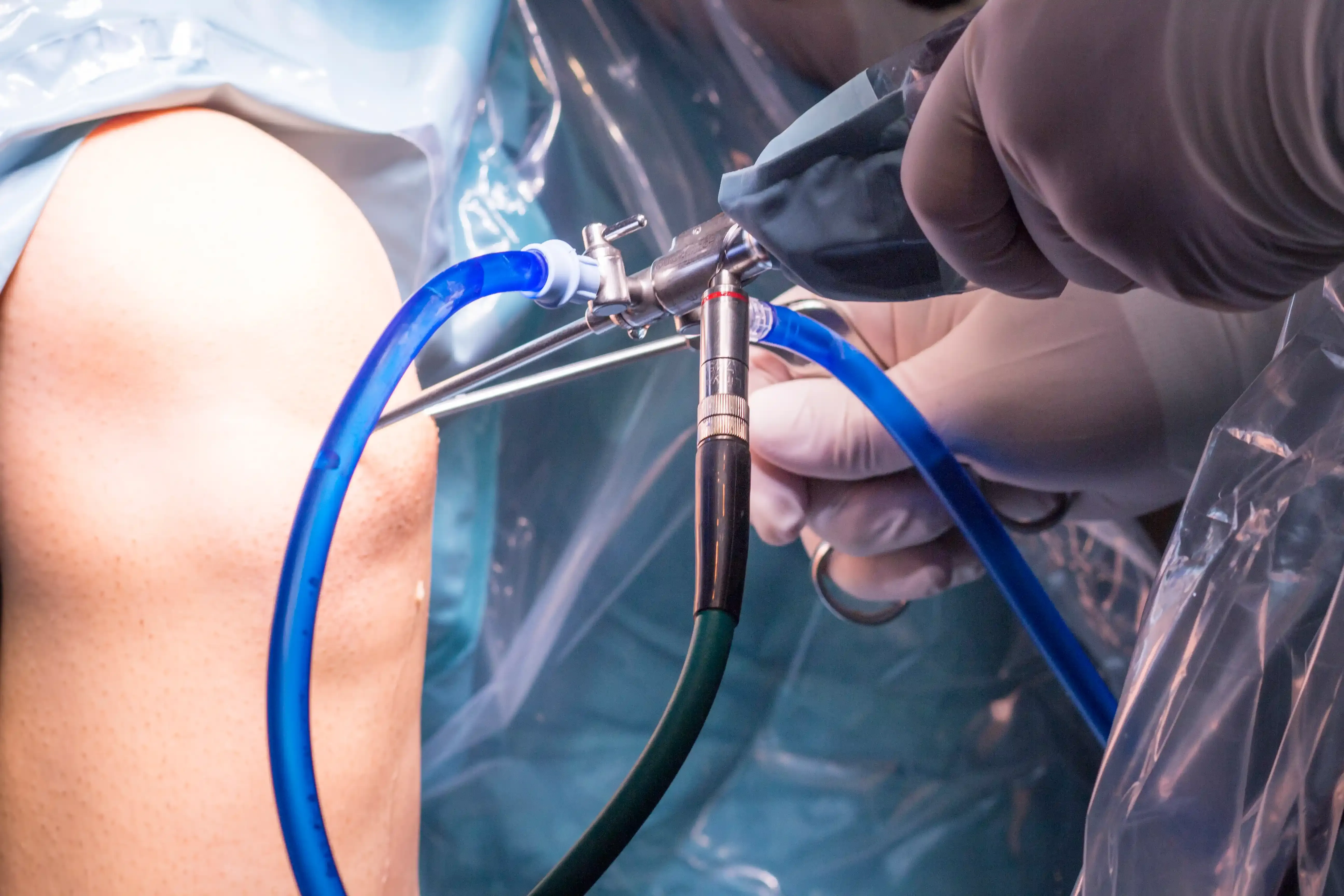 Dr. Leo Chen performing knee arthroscopy at Emerald Coast Ortho in Fort Walton Beach, FL