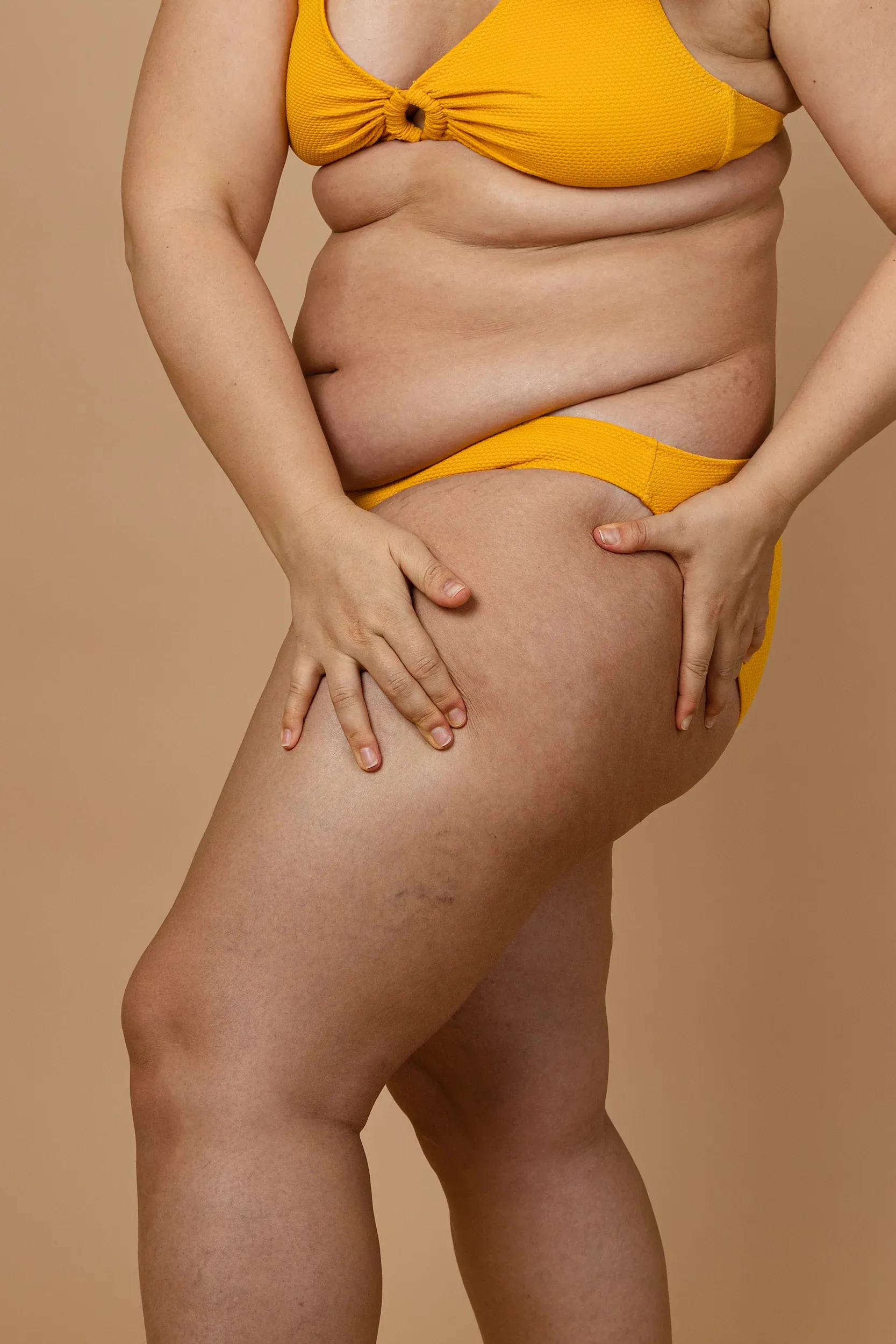 Diagram of collagen and elastin breakdown causing skin laxity at ProActive Chiropractic Tampa