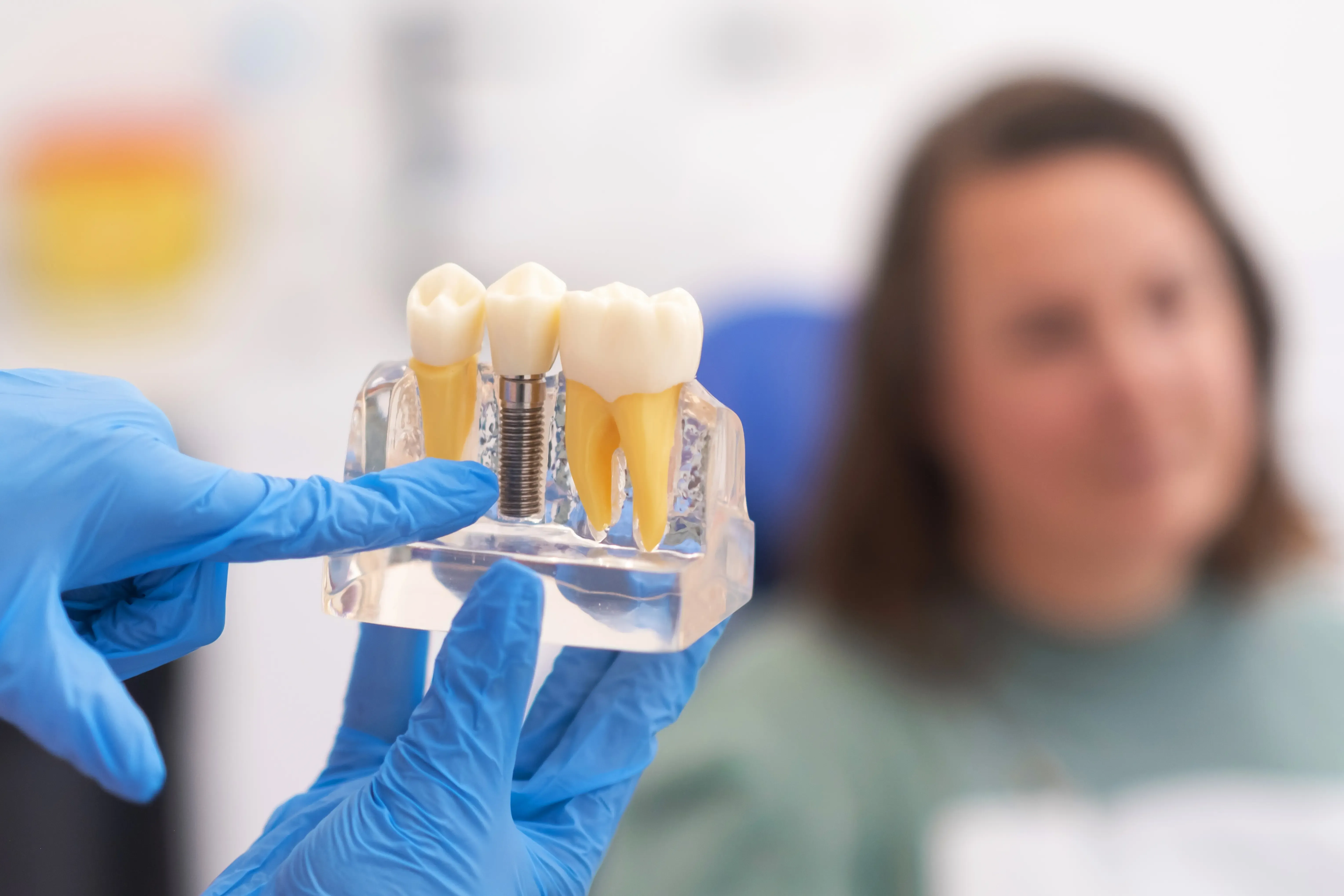 FAQ About Dental Implant Treatment in Lake Mary