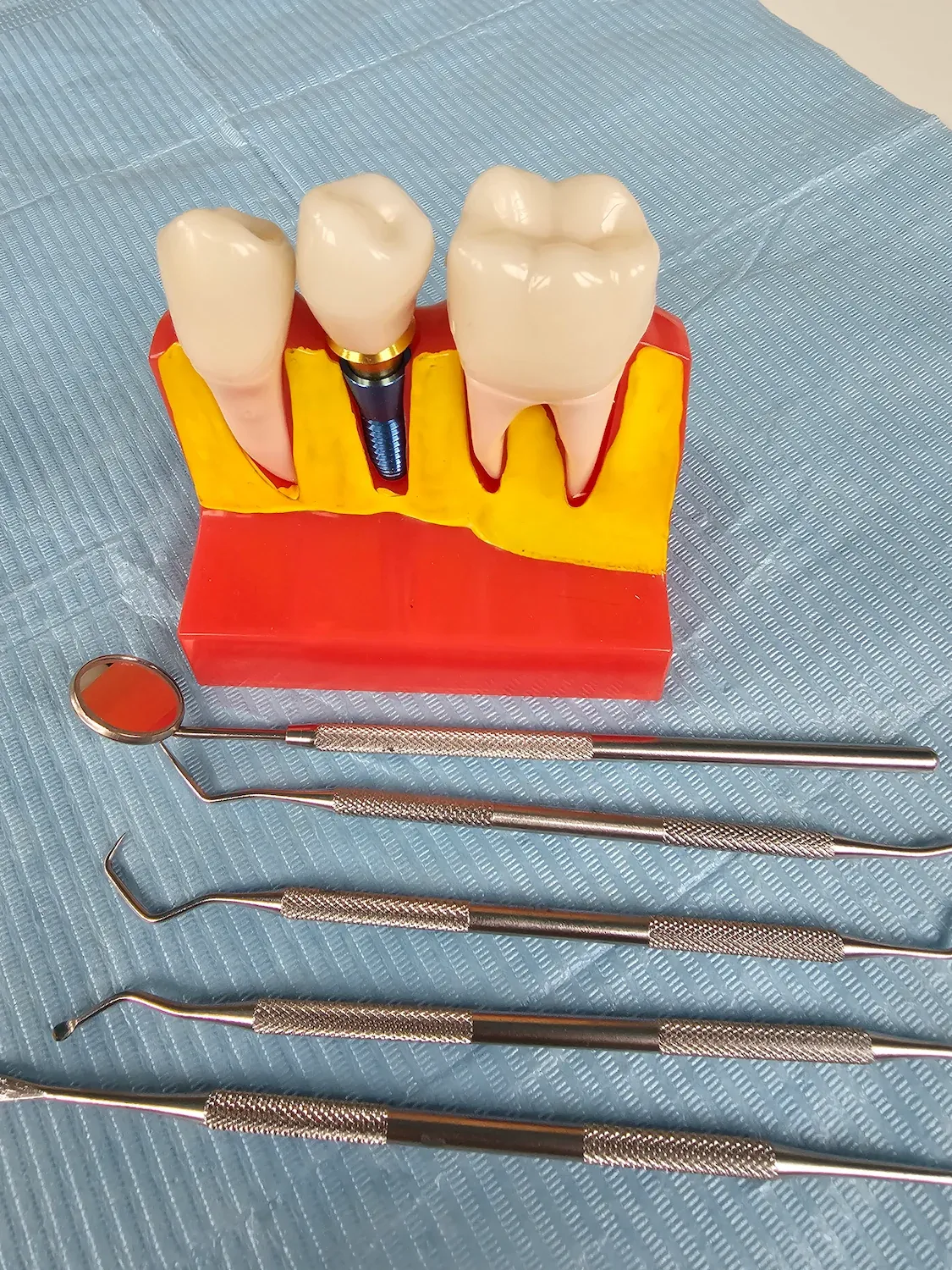 Titanium dental implant components used at Dental World Longwood