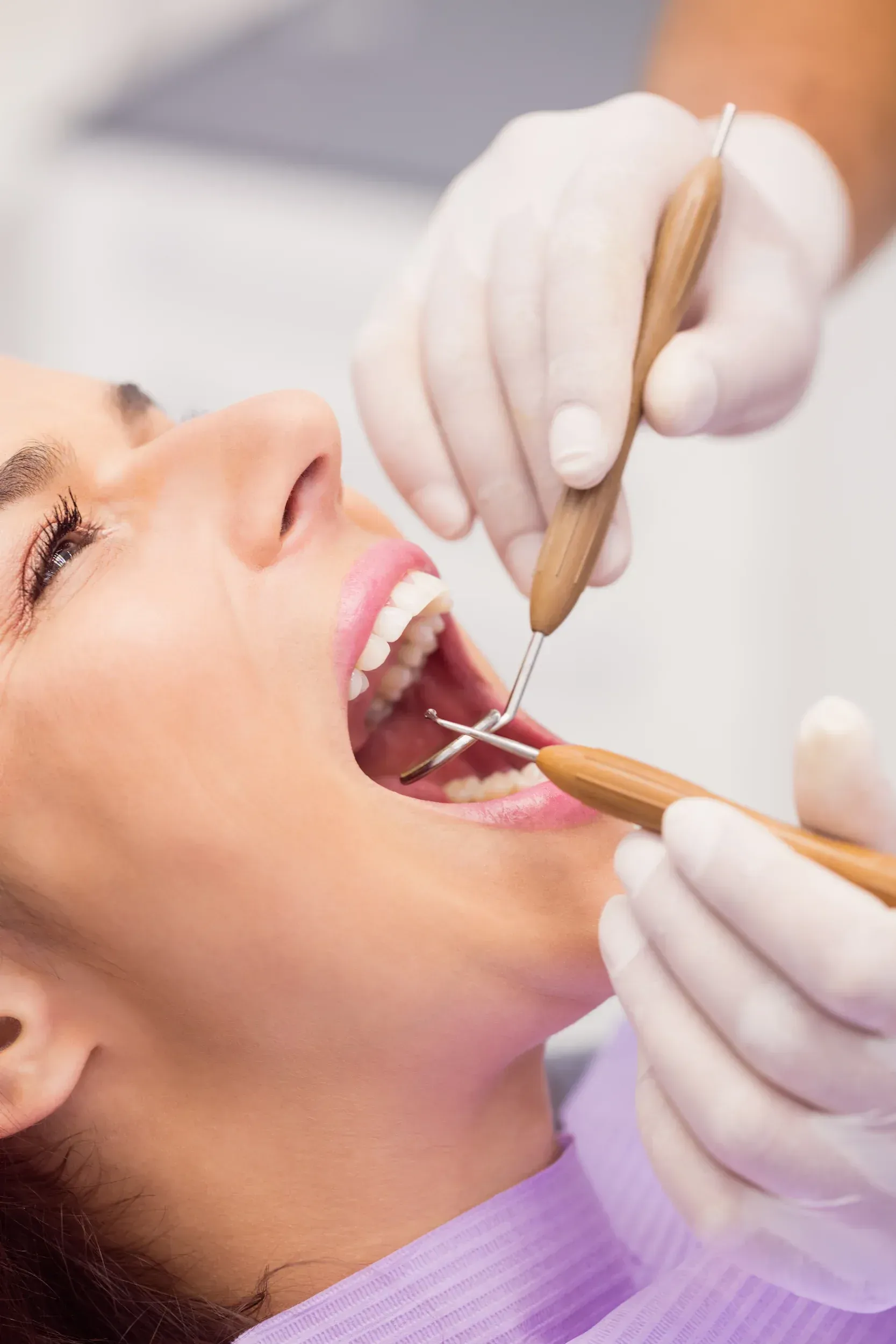Before and after dental sealants results at East Ellijay Dental in East Ellijay, GA