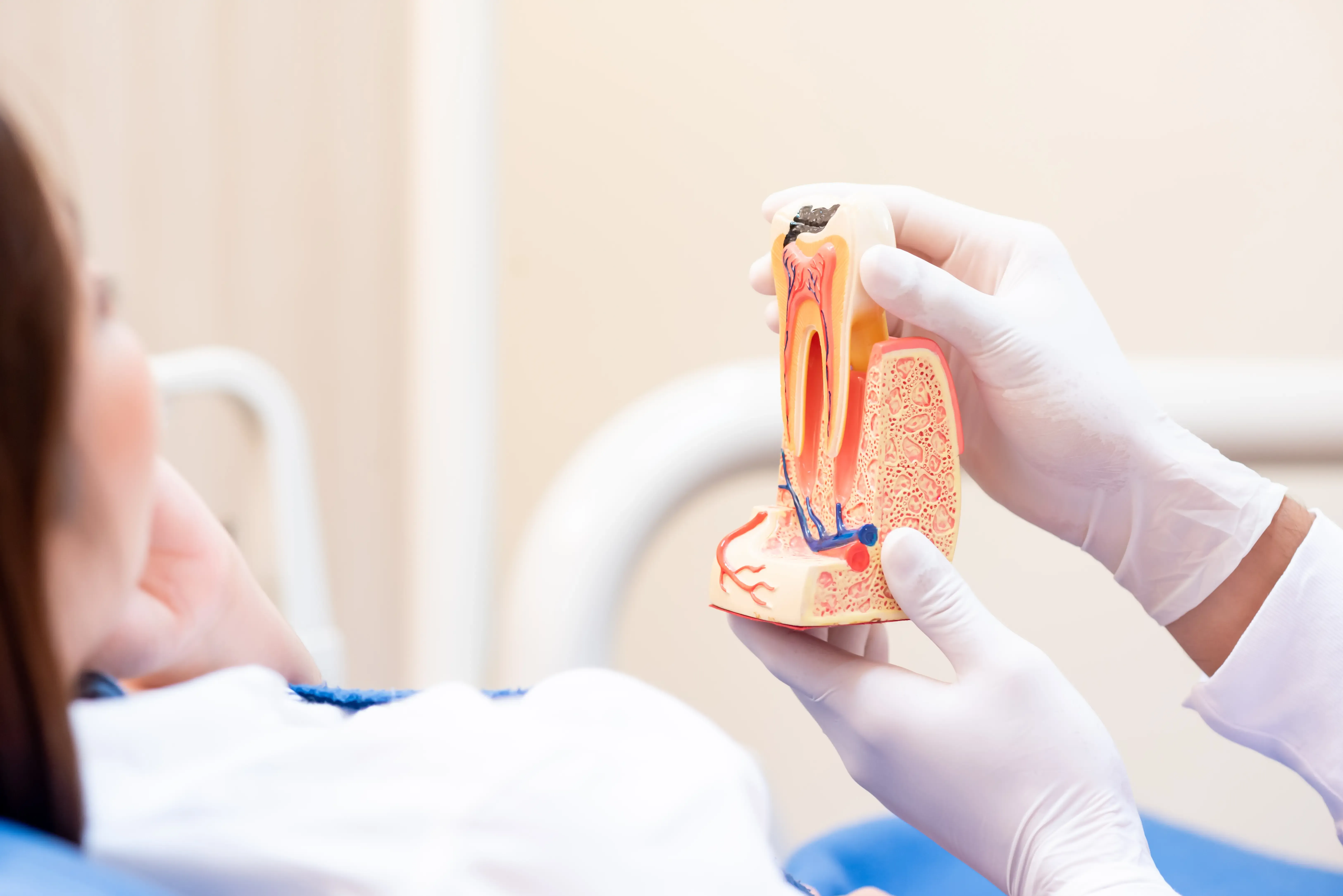 What Is a Root Canal Procedure and Why Is It Needed?