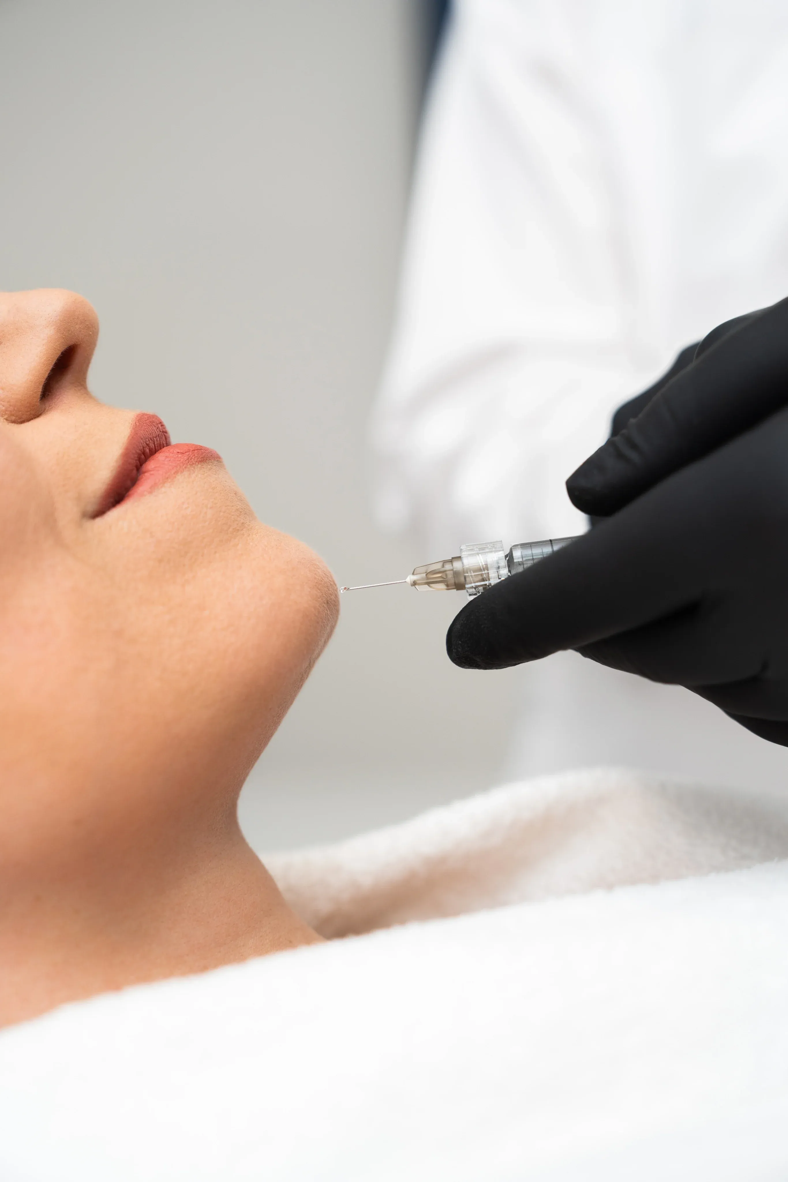 Hyaluronic acid dermal filler syringes used at Anu Face Mind Body Elizabethtown