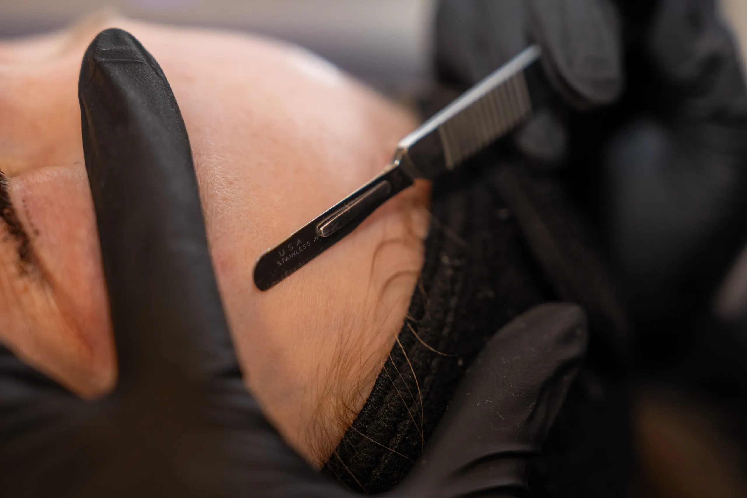 Dermaplaning blade and equipment used at Eternal Wellness Medical Spa Traverse City